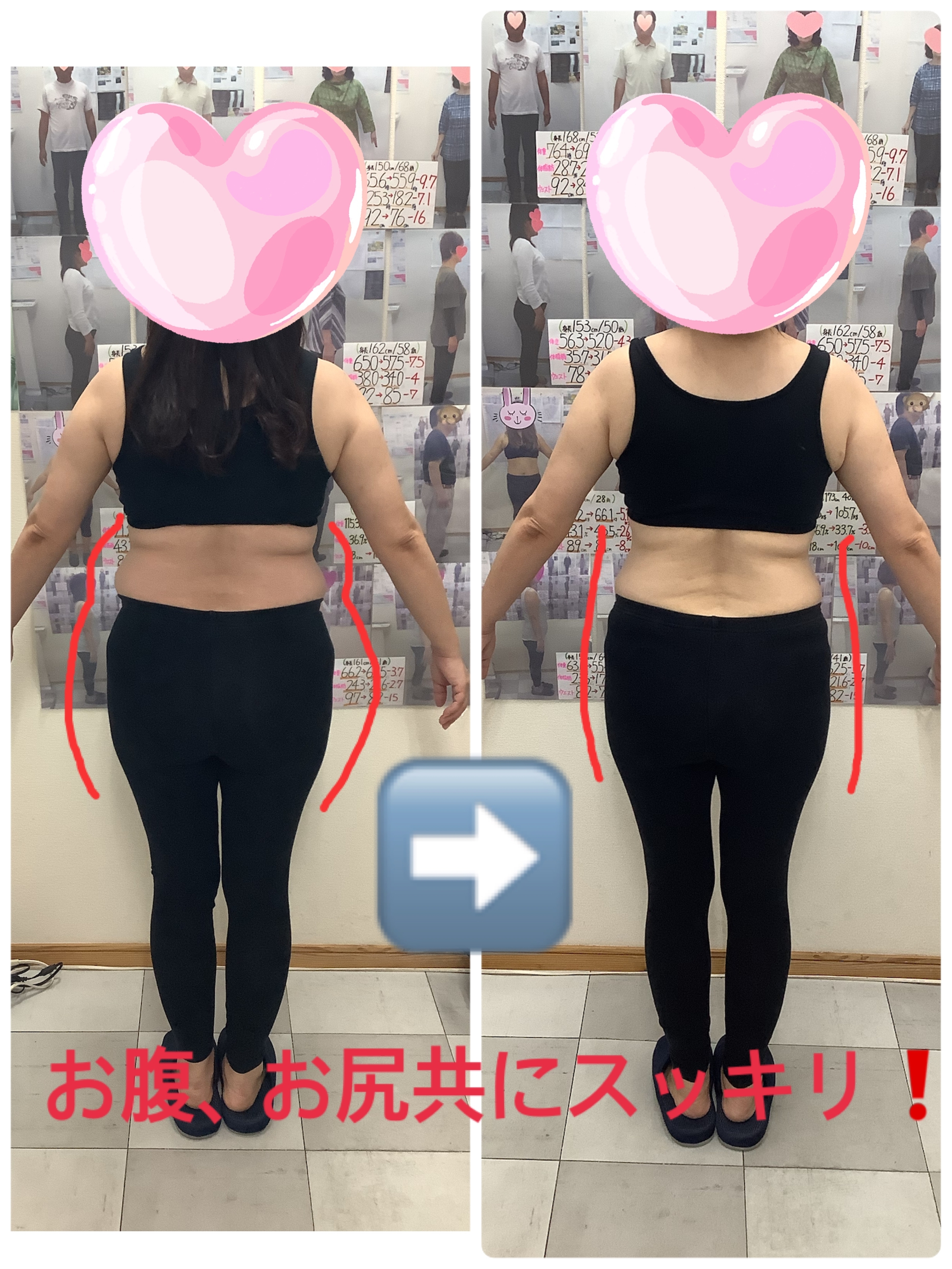 ゆらり整体、耳ツボダイエットビフォーアフターの写真