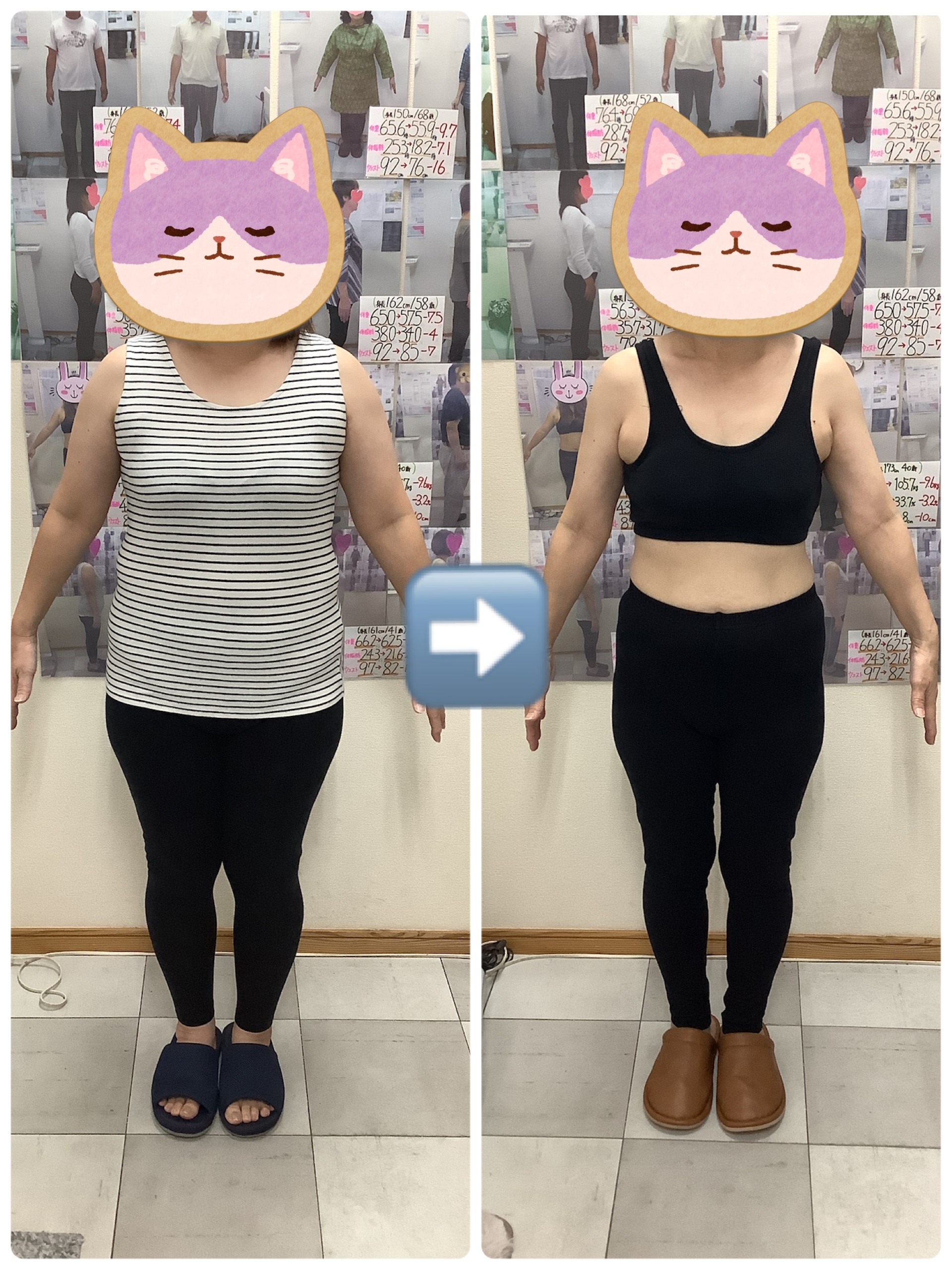 耳ツボダイエット　ビフォーアフターの写真