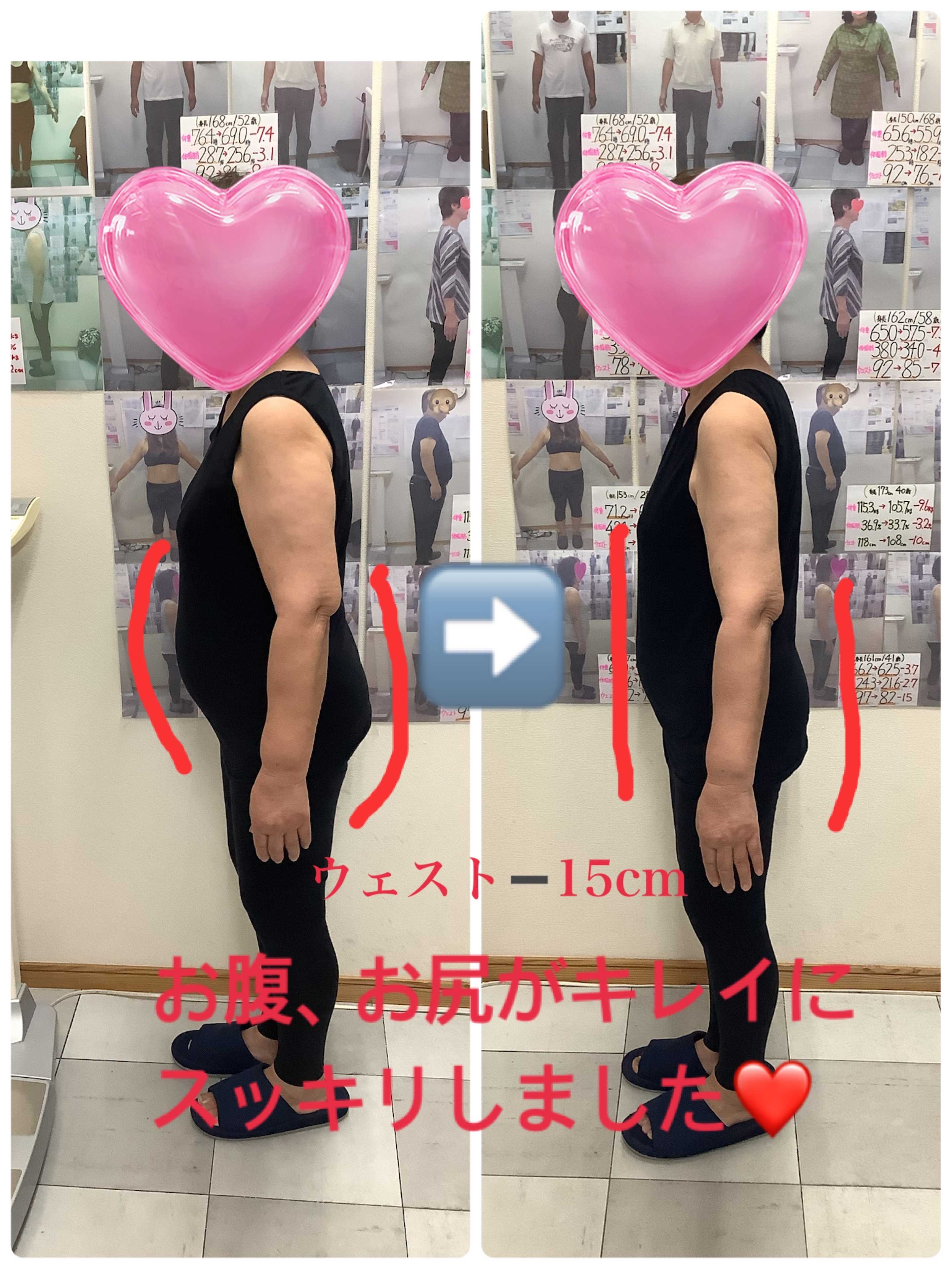 ゆらり整体　耳つぼダイエット　ビフォーアフターの写真