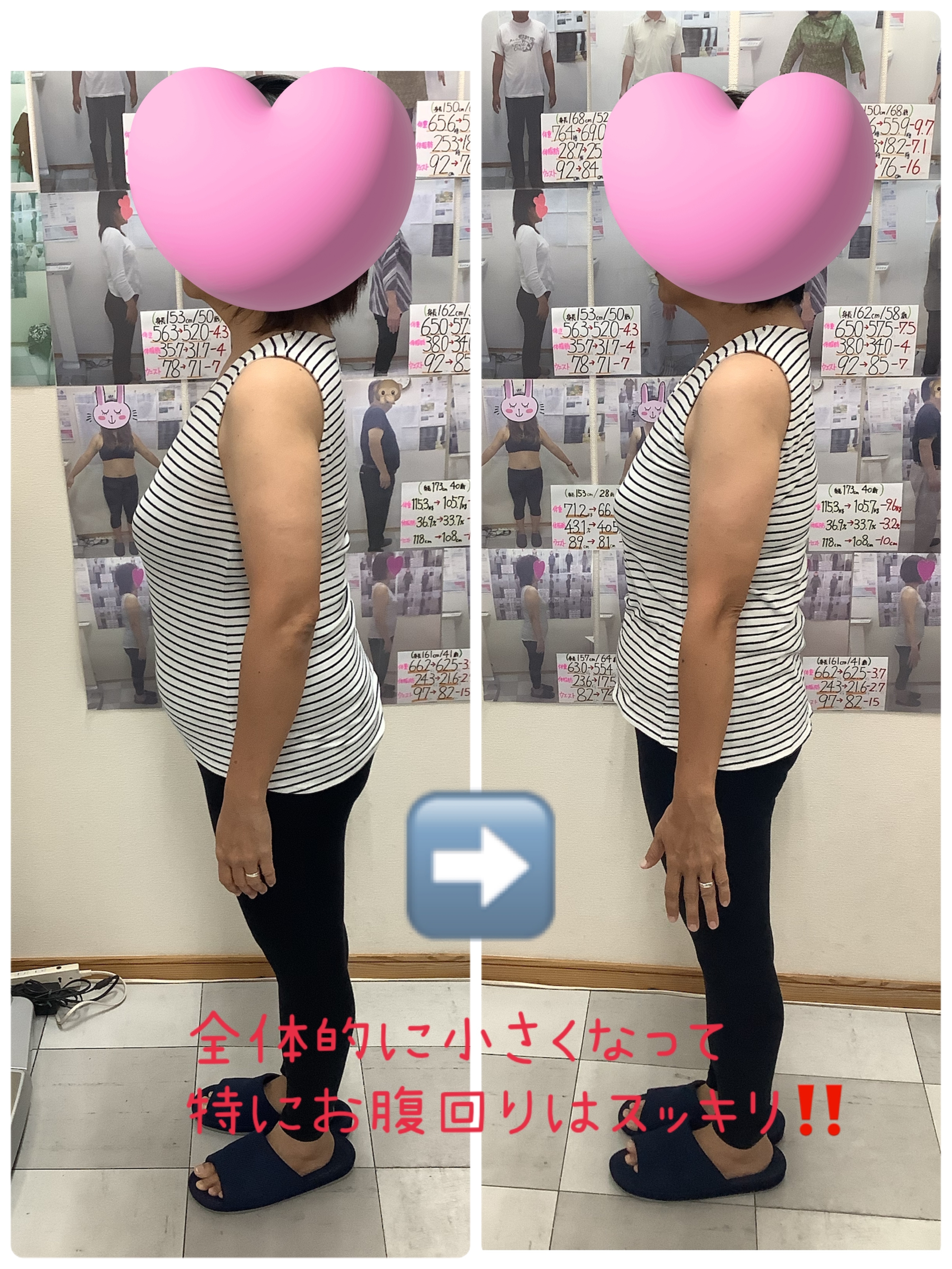 ビフォーアフターの写真　ゆらり整体・耳つぼダイエット