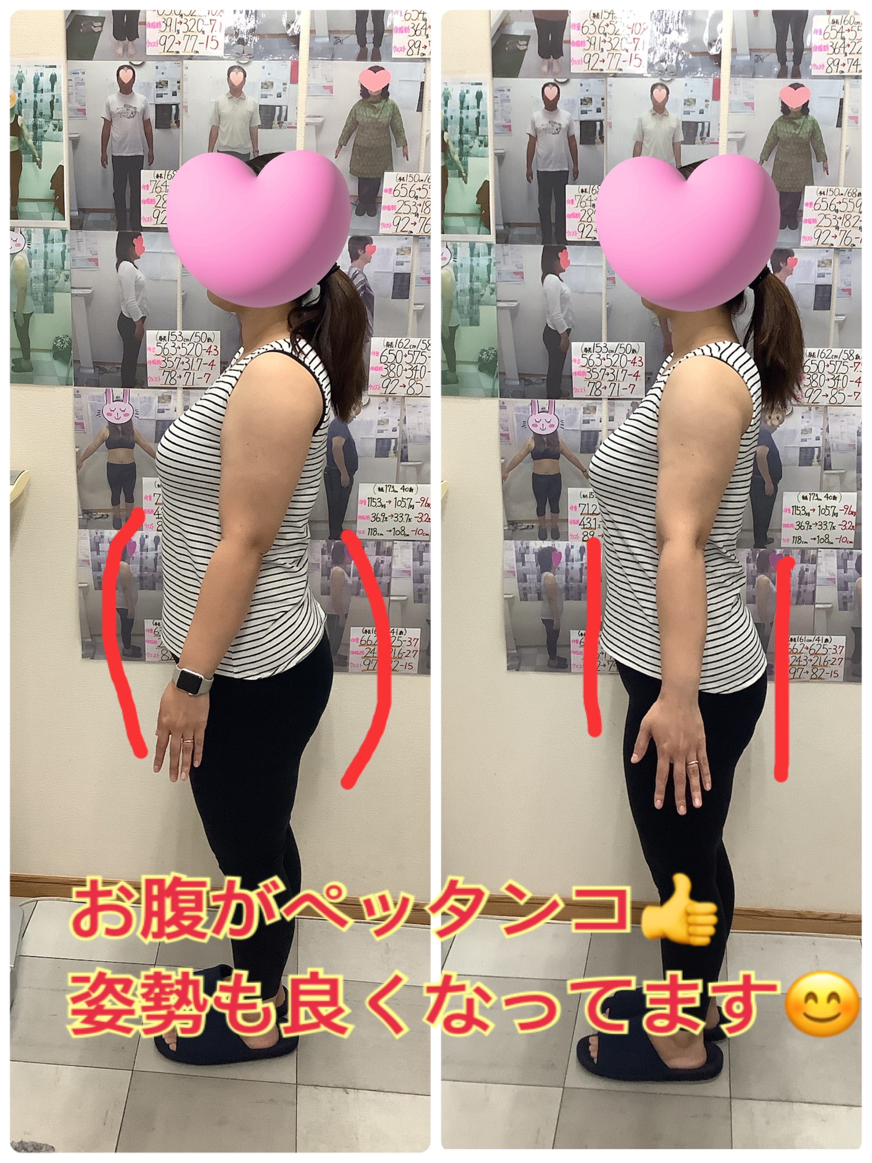 ゆらり整体　耳ツボダイエット　ビフォーアフターの写真