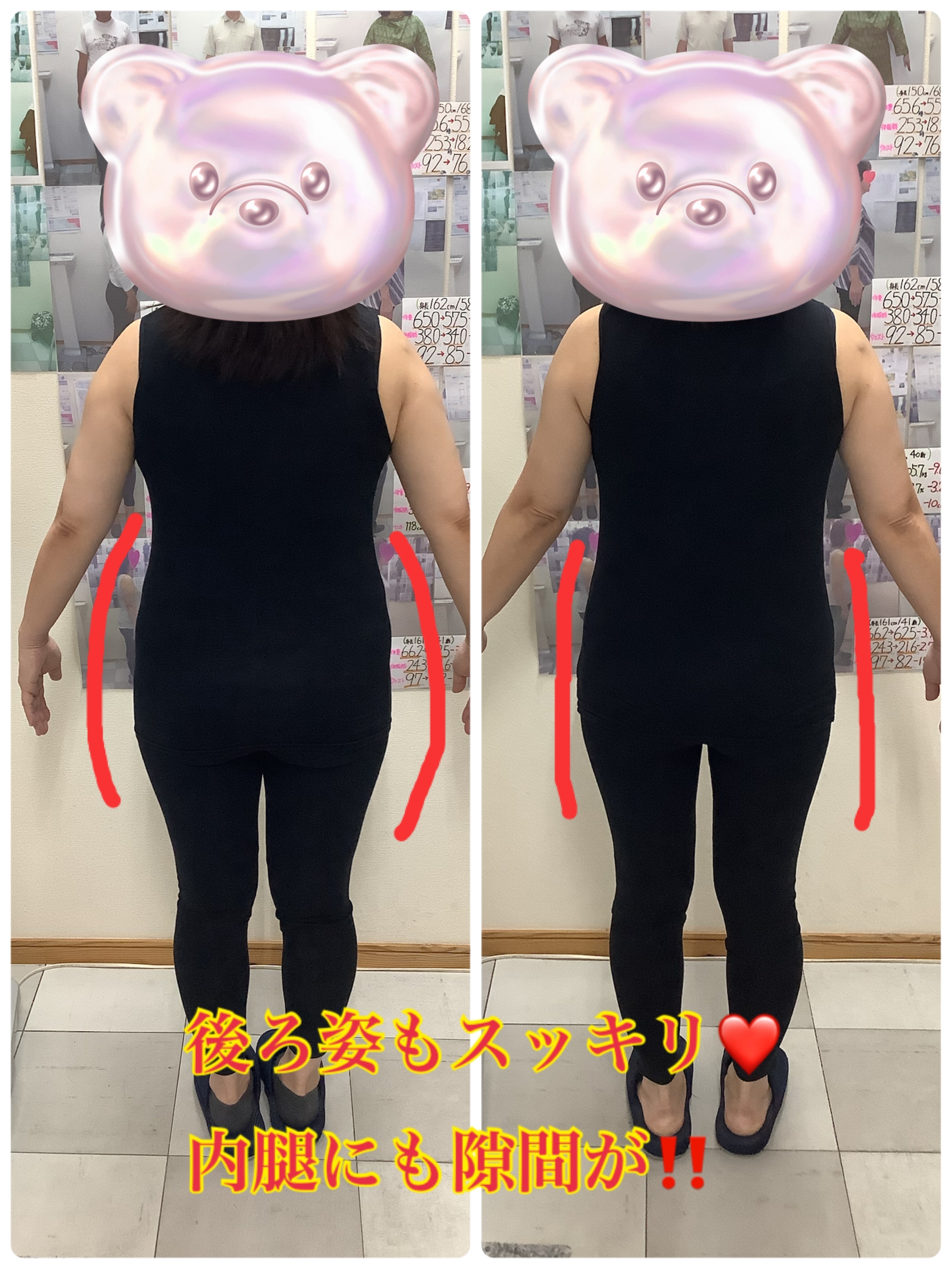 耳ツボダイエット　ビフォーアフター