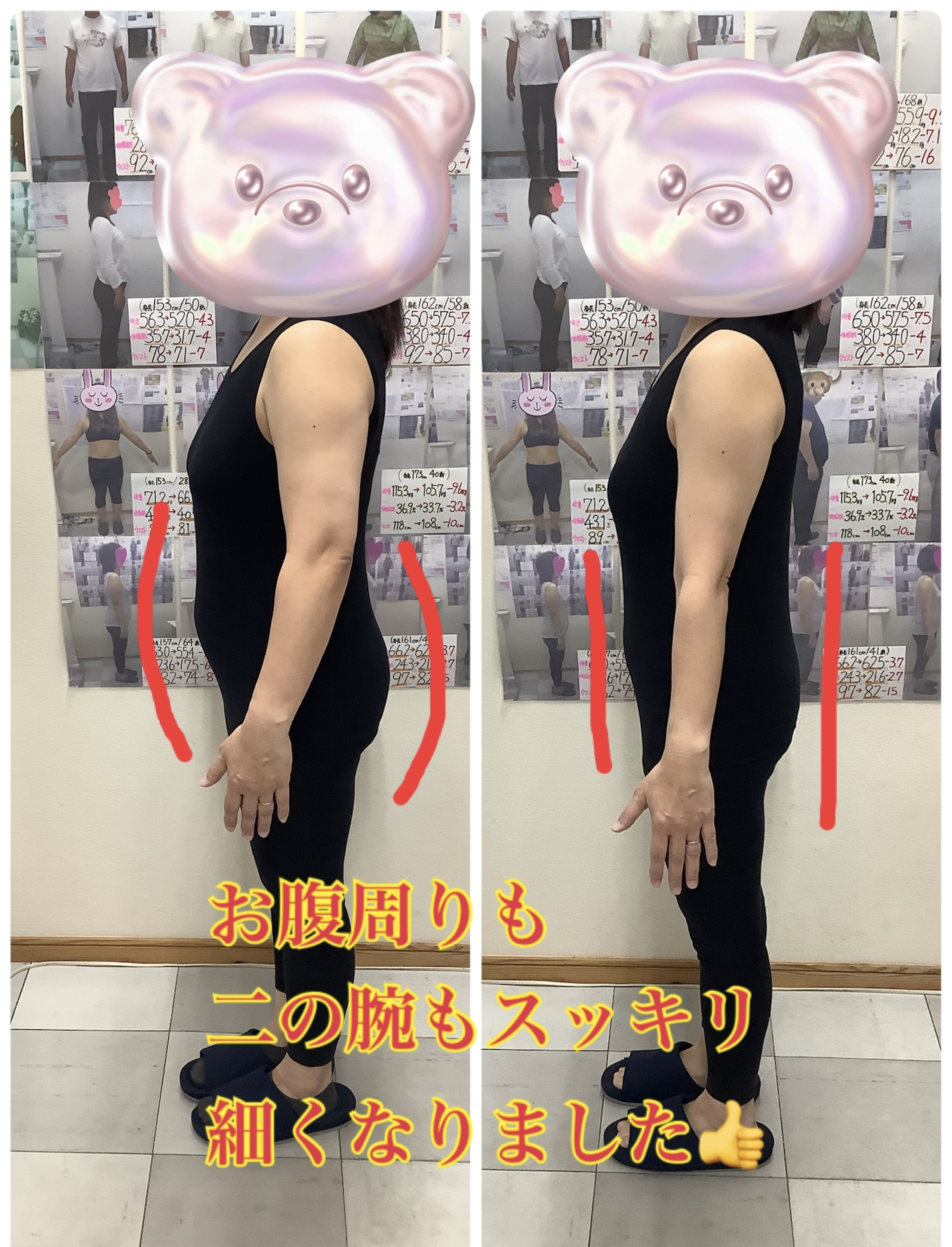 ゆらり整体のヘルシー耳ツボダイエット　ビフォーアフター