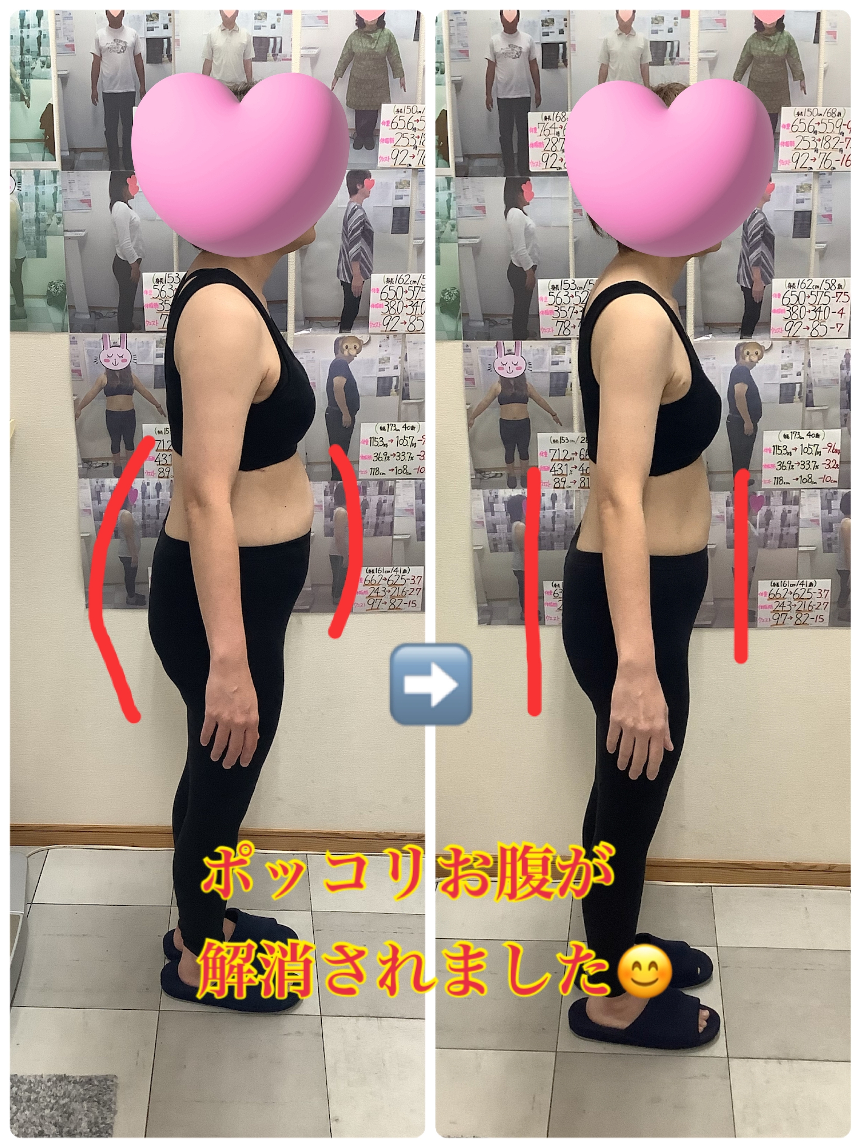 ゆらり整体　耳ツボダイエット　ビフォーアフター