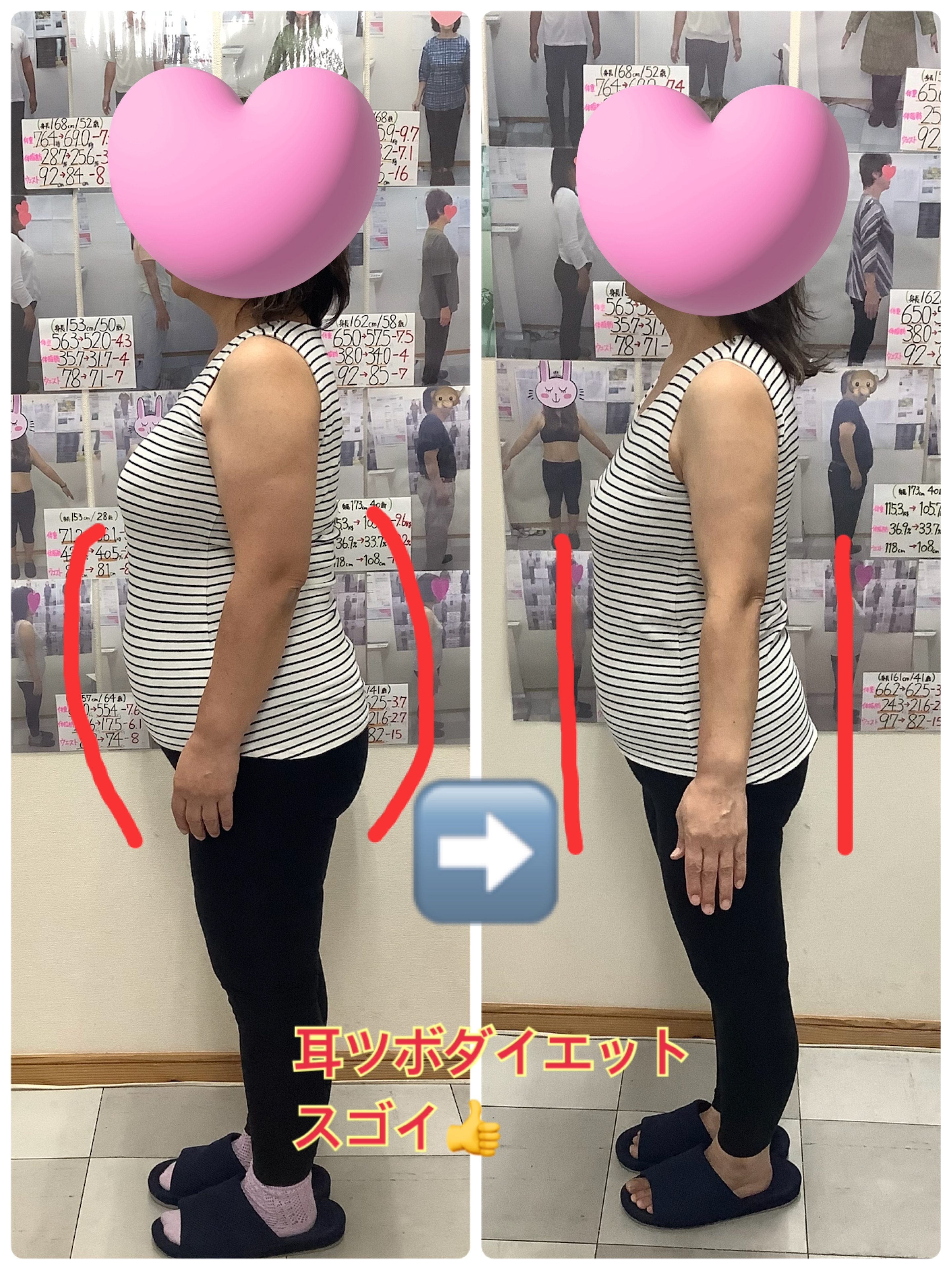 ゆらり整体、耳ツボダイエット　ビフォーアフターの写真