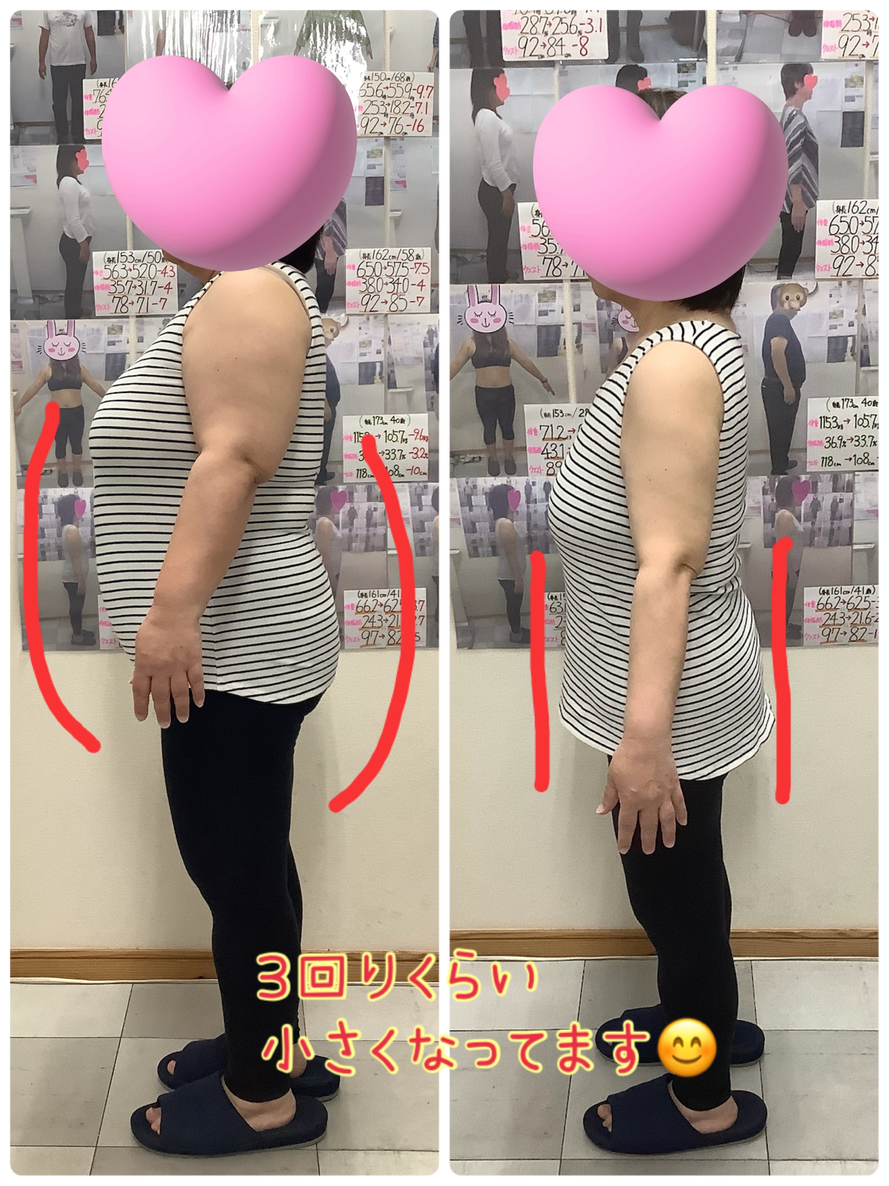 ゆらり整体、耳ツボダイエット　ビフォーアフターの写真