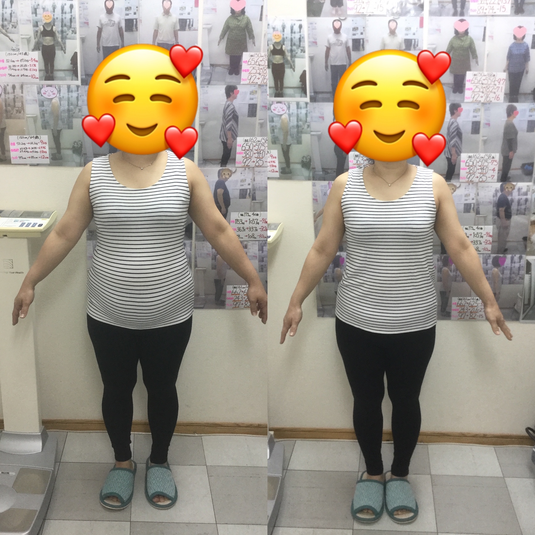 耳ツボダイエット　ビフォーアフターの写真