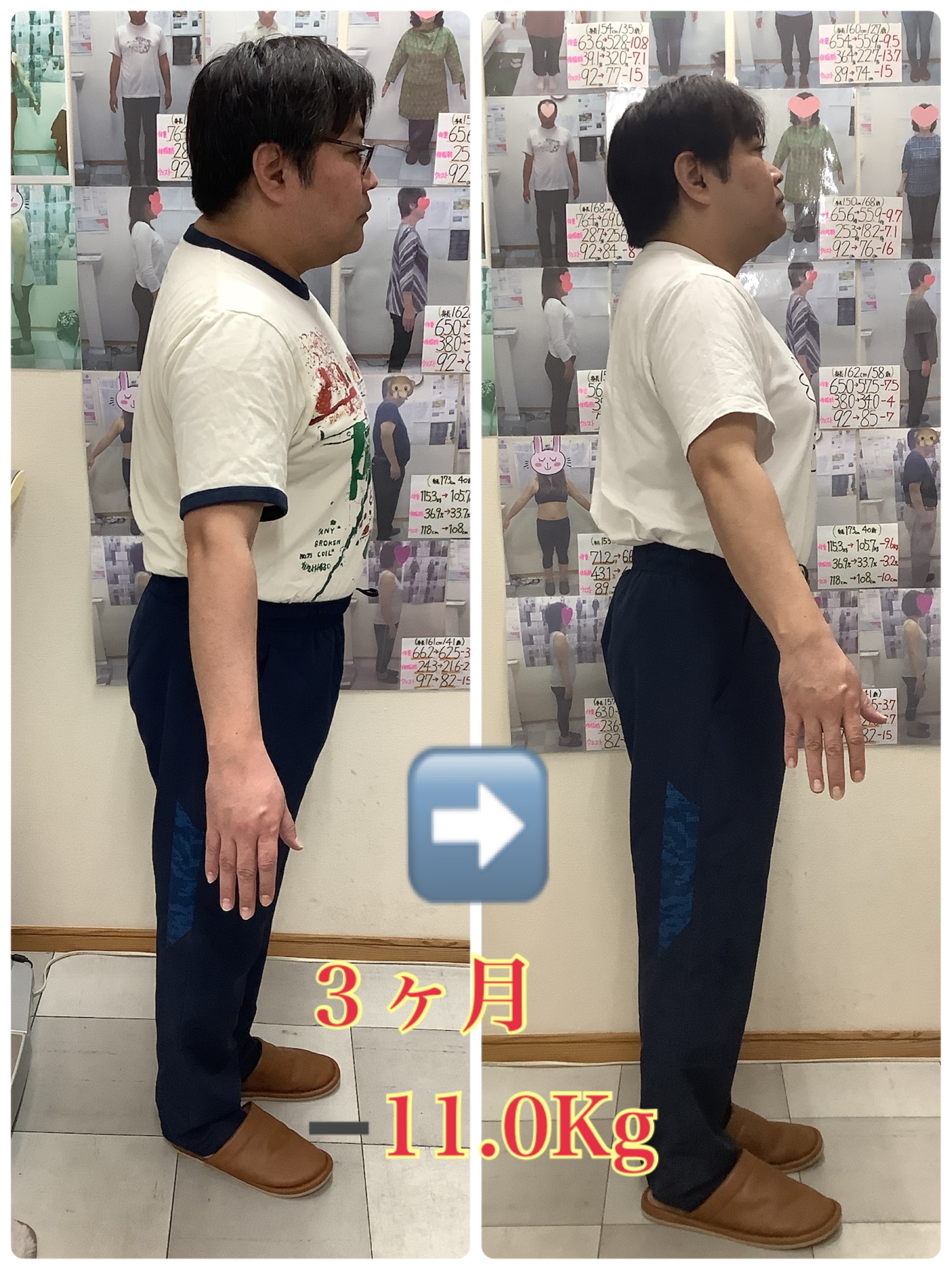 耳ツボダイエットビフォーアフターの写真