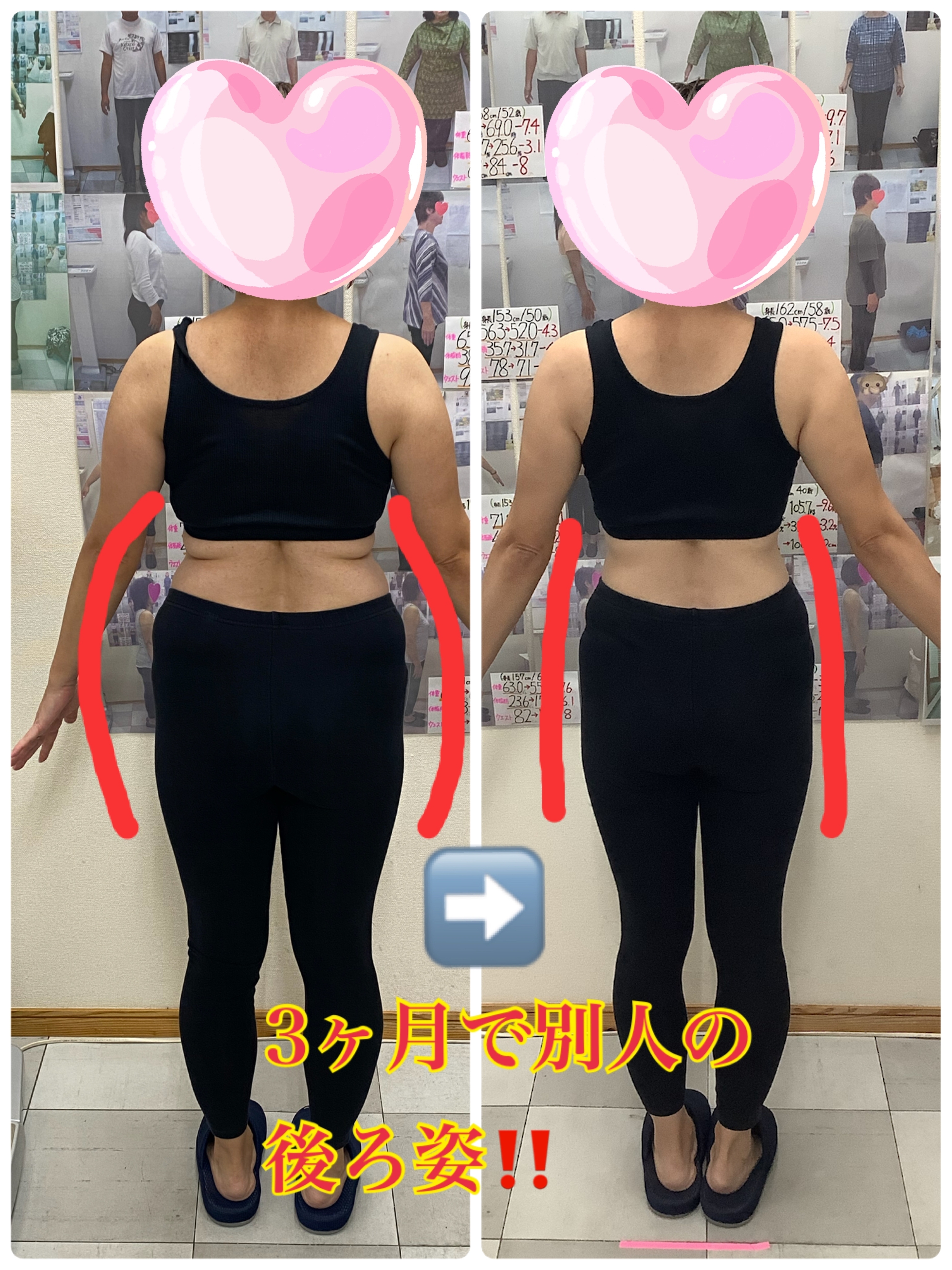 ビフォーアフターの写真　耳ツボダイエット