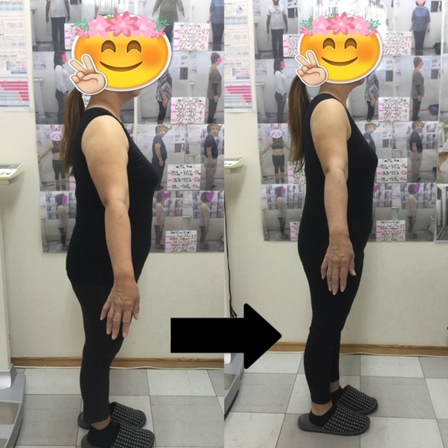 耳ツボダイエット卒業生のビフォーアフター写真