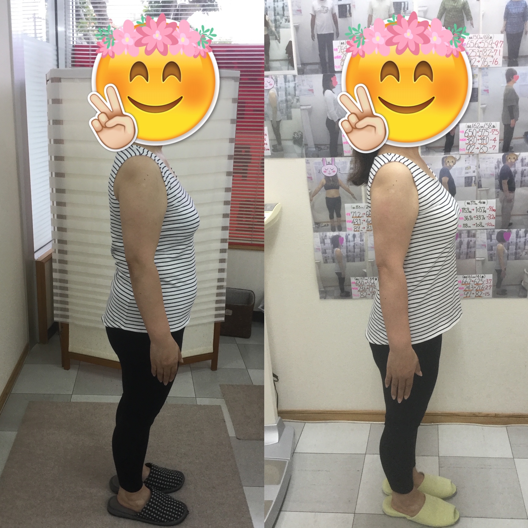 耳ツボダイエット　ビフォーアフターの写真