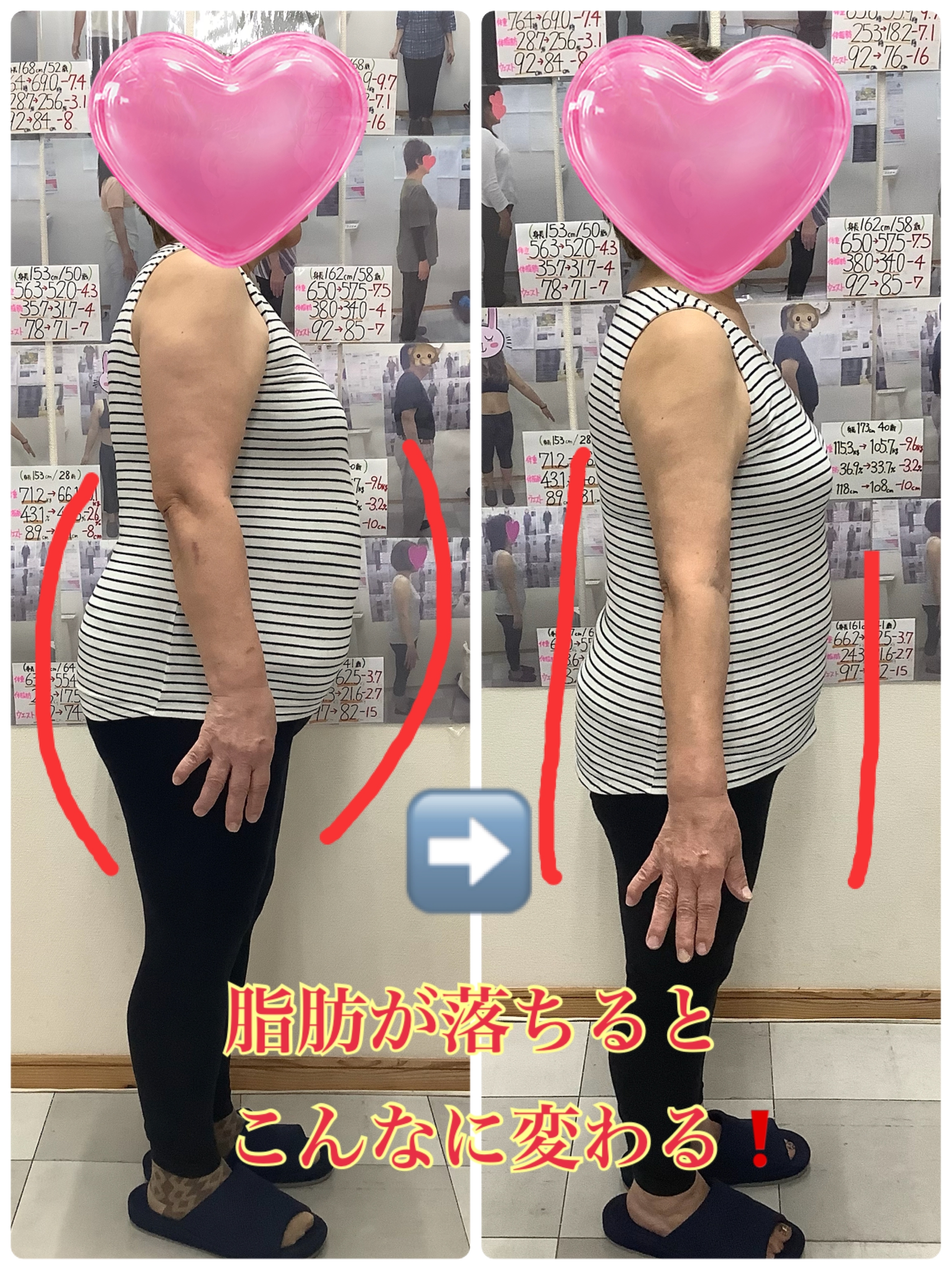 耳ツボダイエット　ビフォーアフターの写真