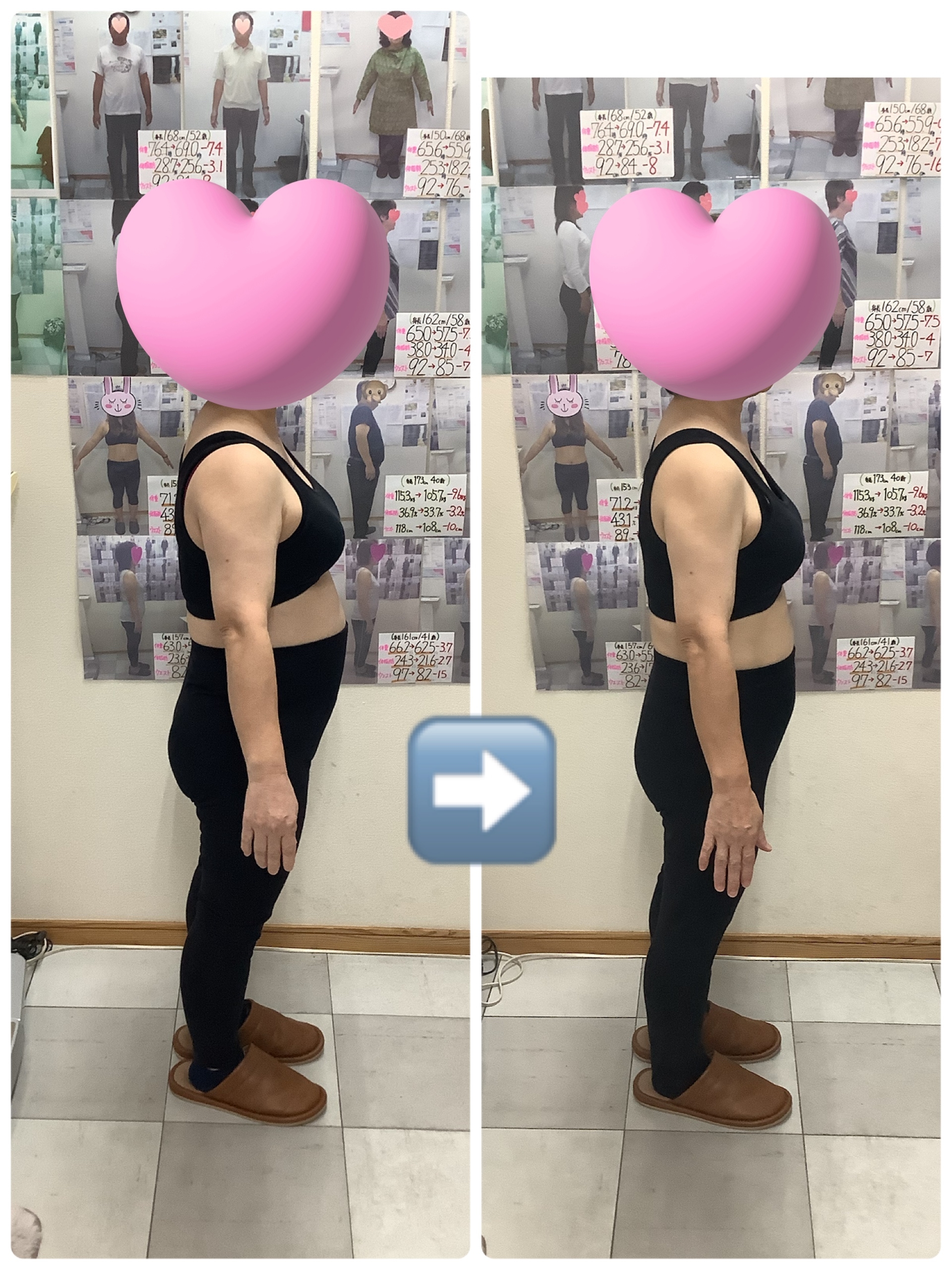 耳ツボダイエット ビフォーアフターの写真