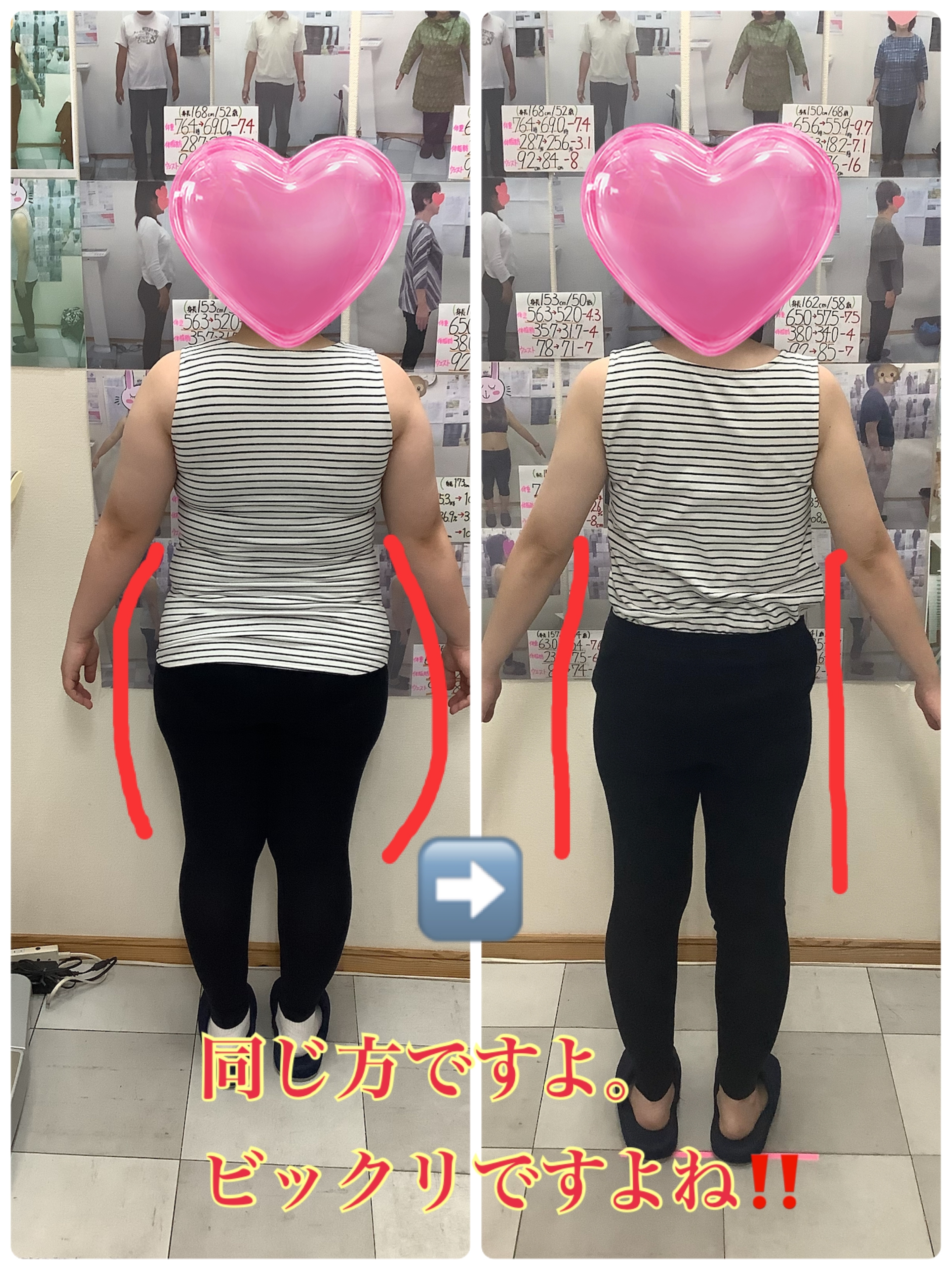 耳ツボダイエット　ビフォーアフターの写真