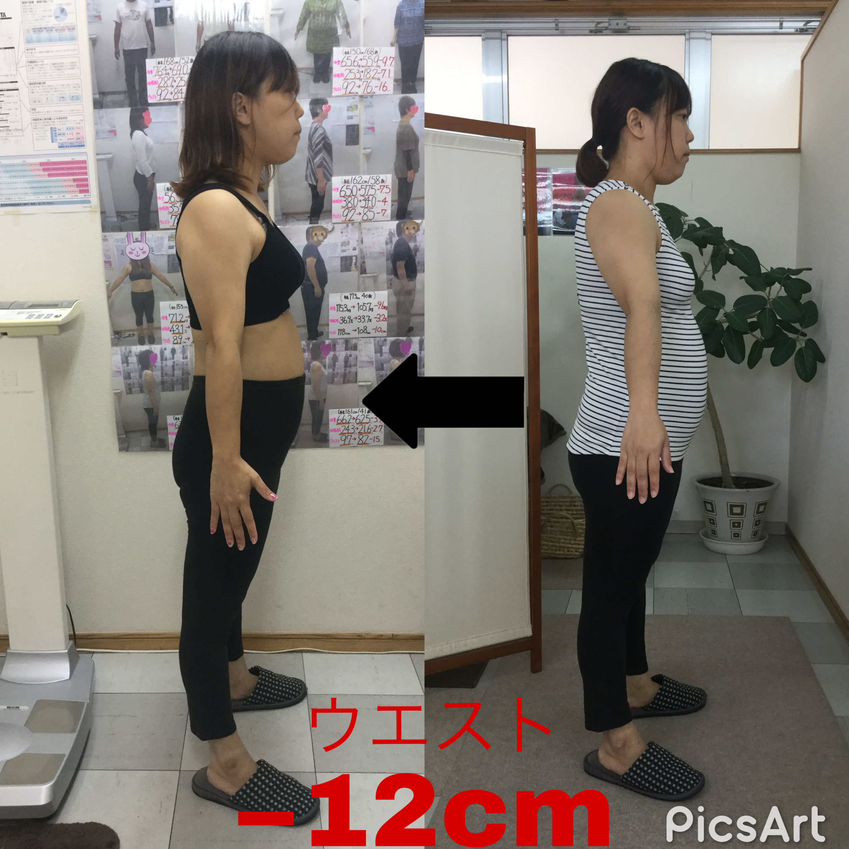 耳ツボダイエットビフォーアフターの写真