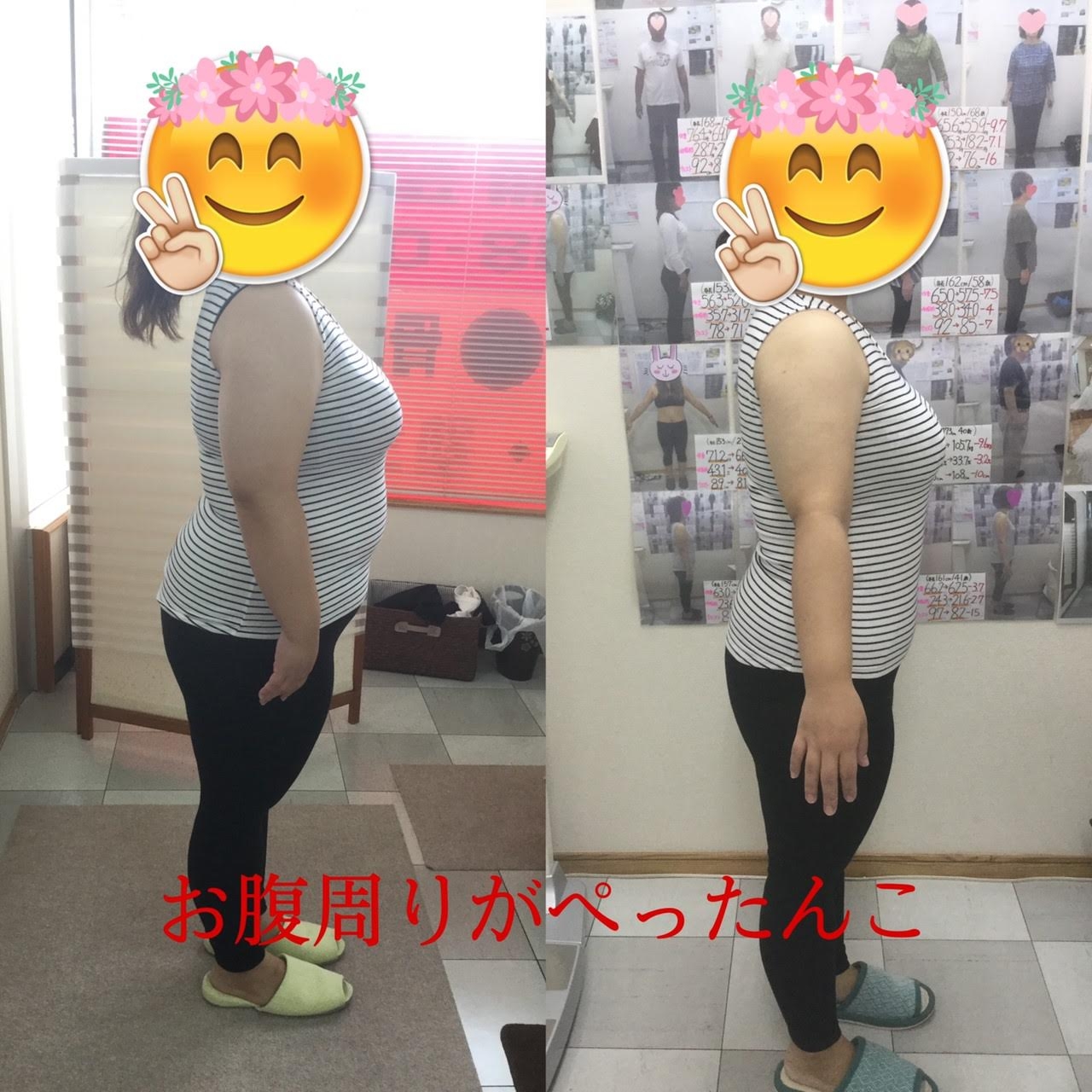 耳ツボダイエット　ビフォーアフターの写真