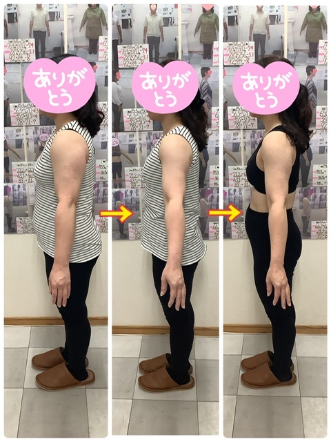 79