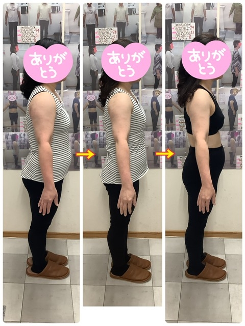 79