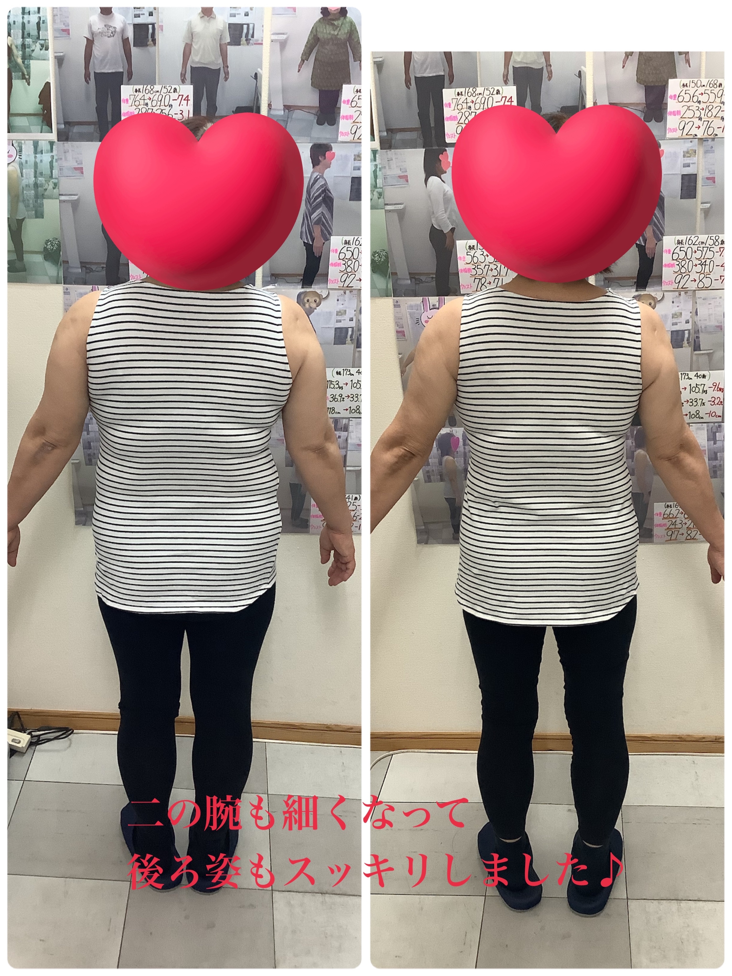 ゆらり整体・耳ツボダイエット　ビフォーアフターの写真です。