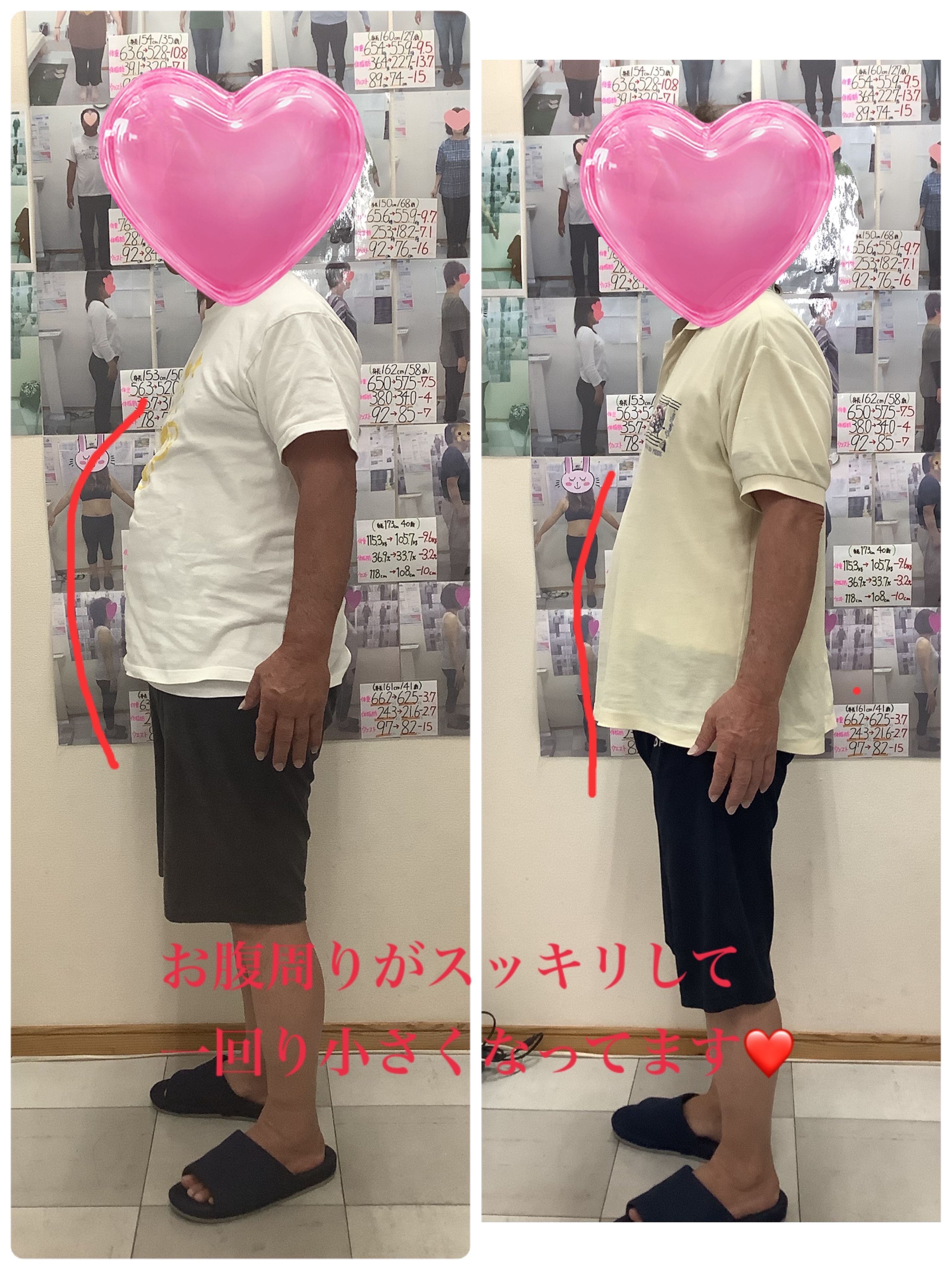 ゆらり整体・耳ツボダイエット　ビフォーアフターの写真です。