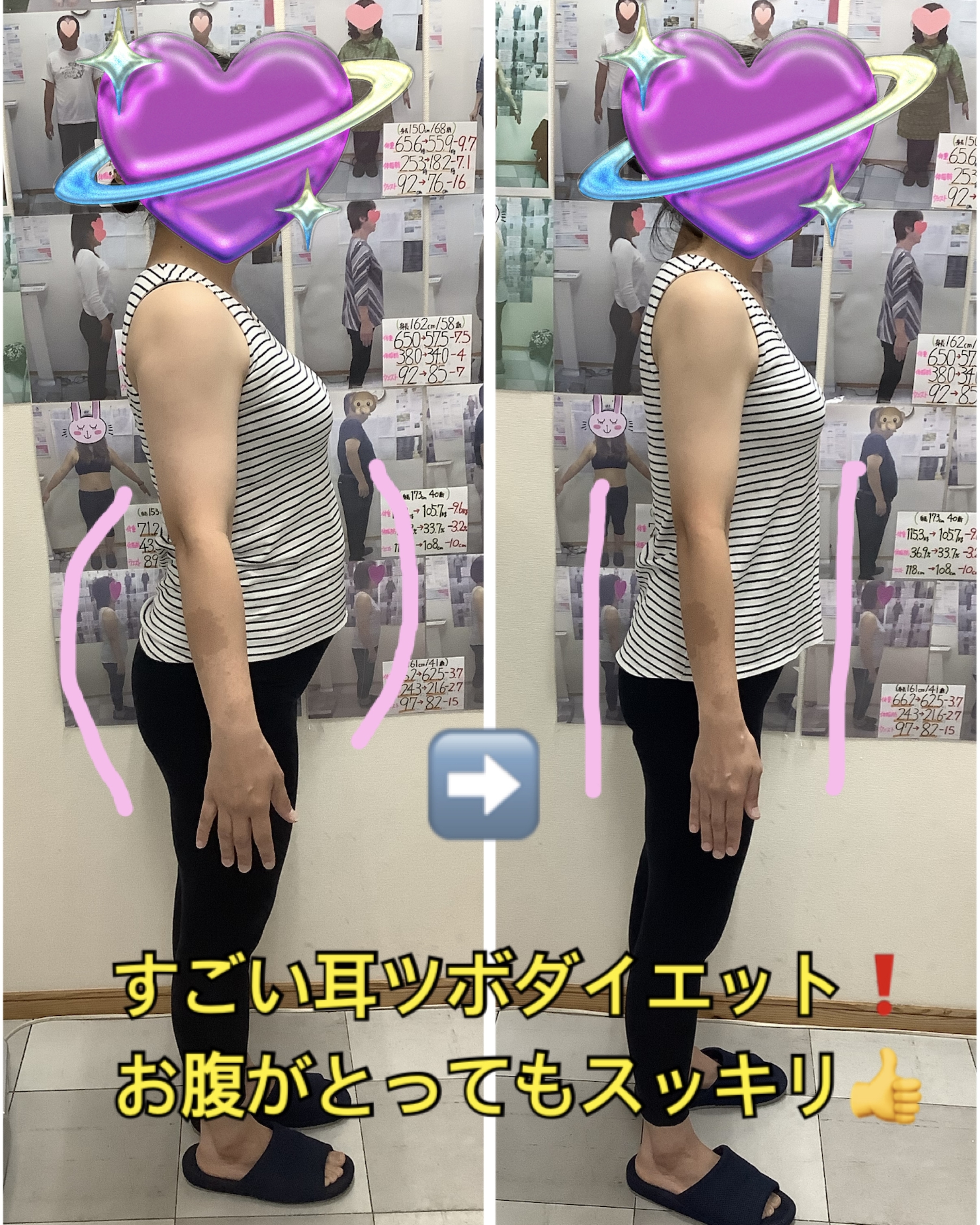 ＃沖縄ダイエット　ゆらり整体　＃耳ツボダイエット　ビフォーアフター