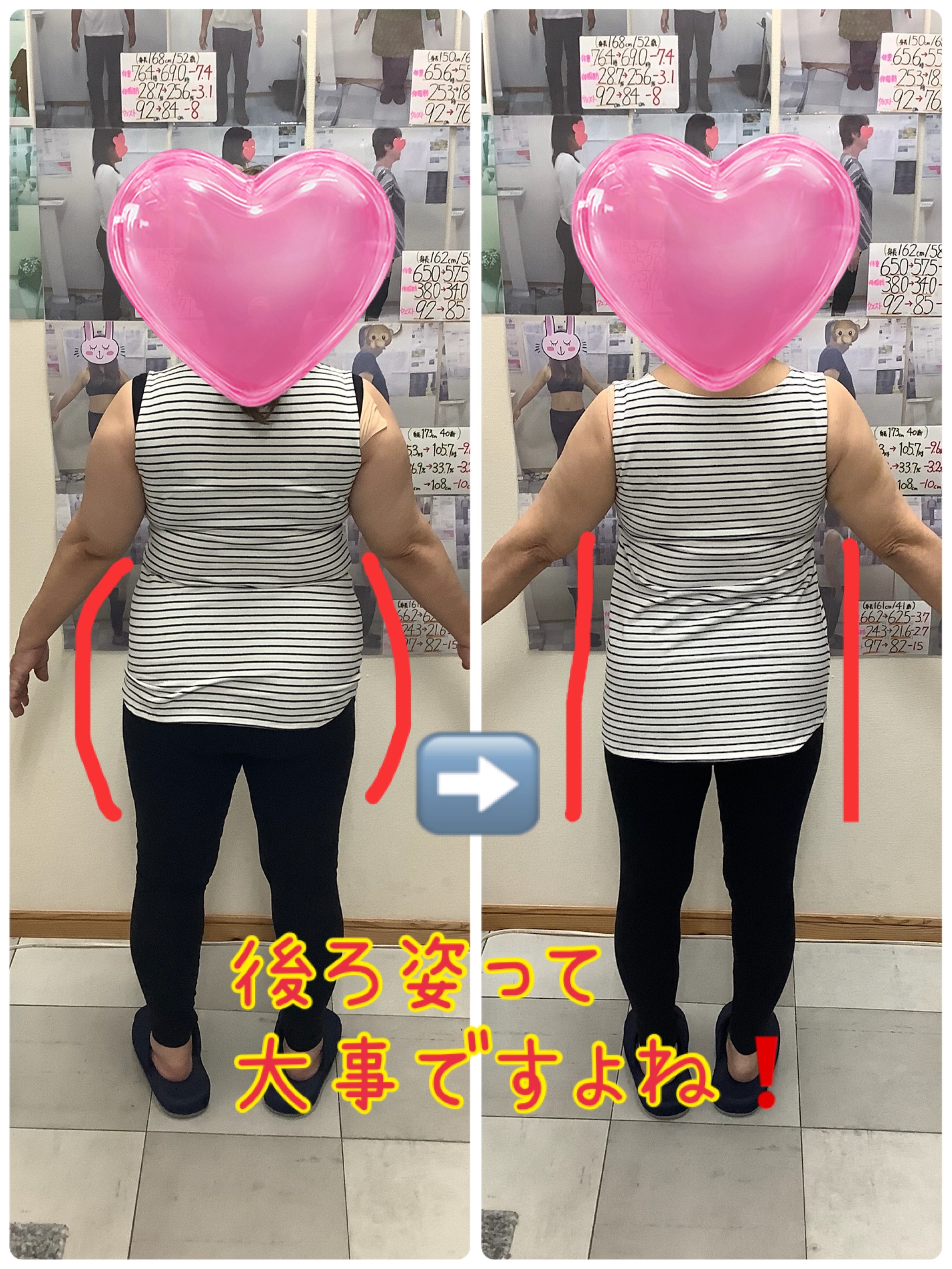 耳ツボダイエット　ビフォーアフターの写真