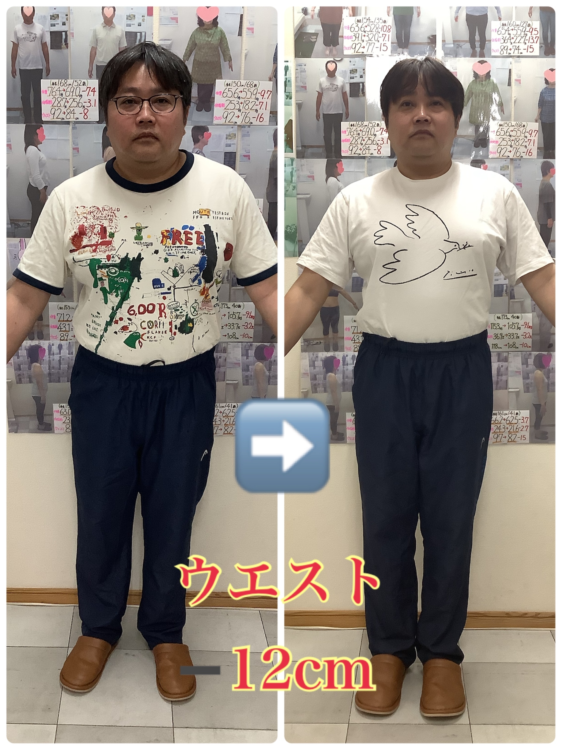 耳ツボダイエットビフォーアフターの写真
