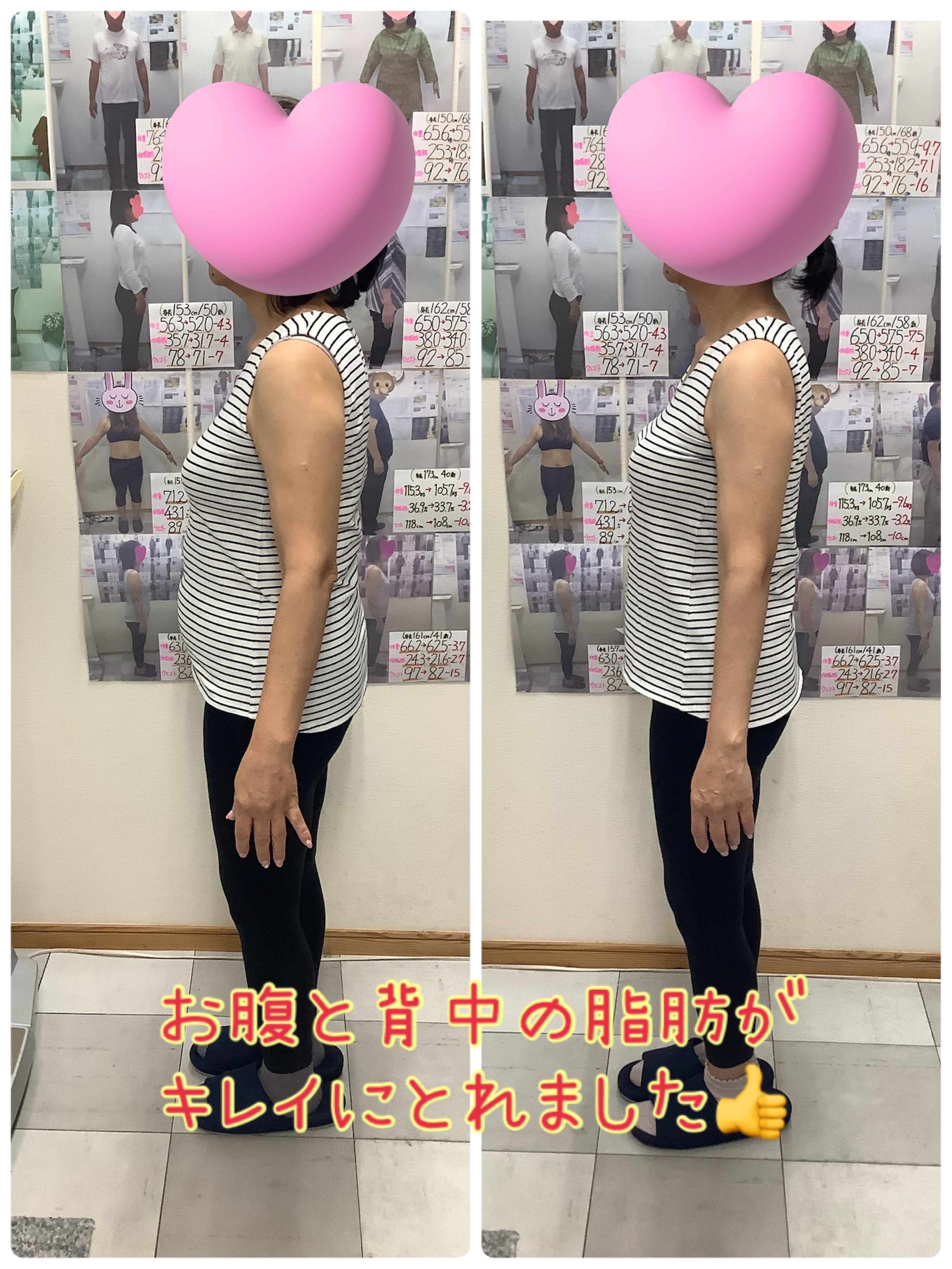 ゆらり整体　耳ツボダイエット　ビフォーアフターの写真