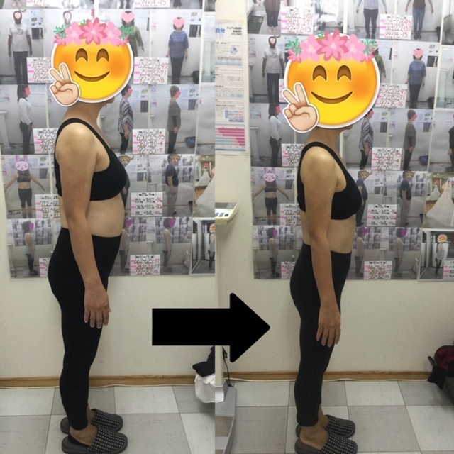 ゆらり整体　耳ツボダイエット　ビフォーアフター写真