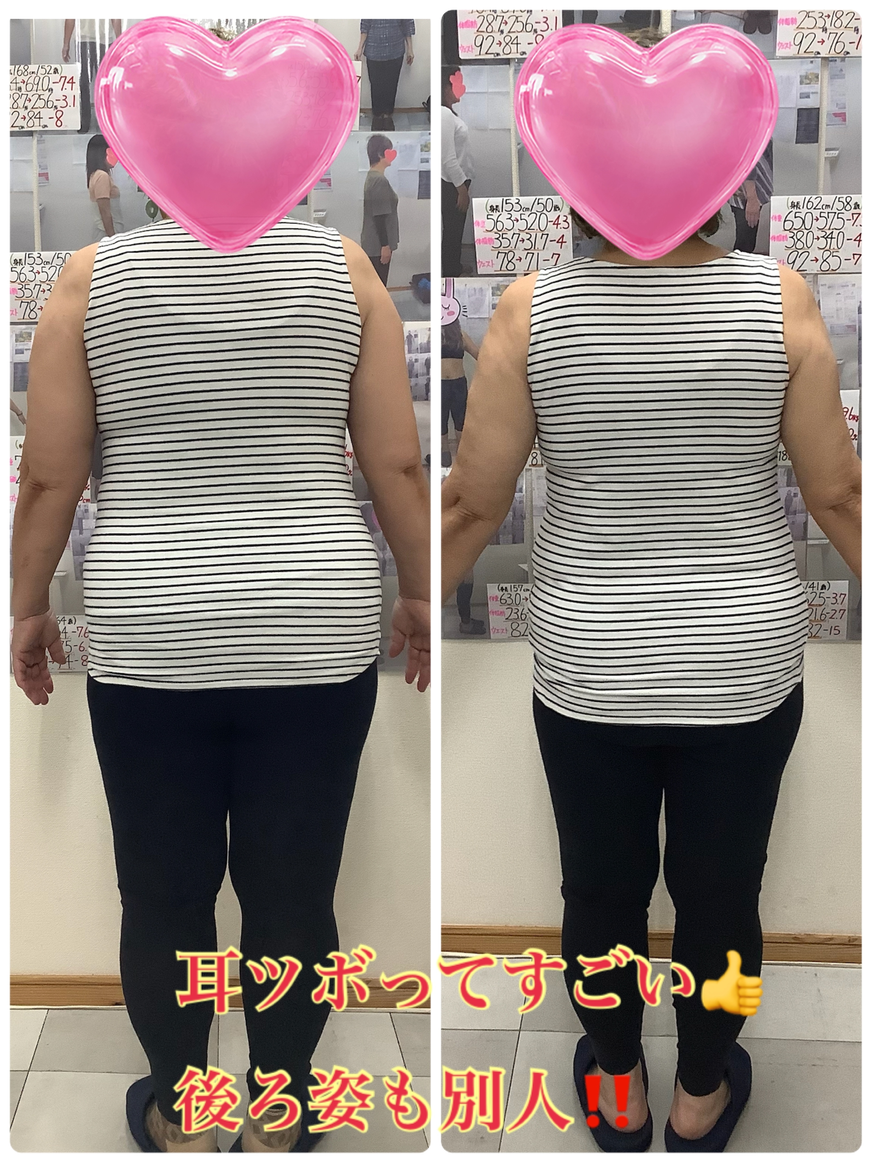 ゆらり整体　耳ツボダイエット　ビフォーアフターの写真