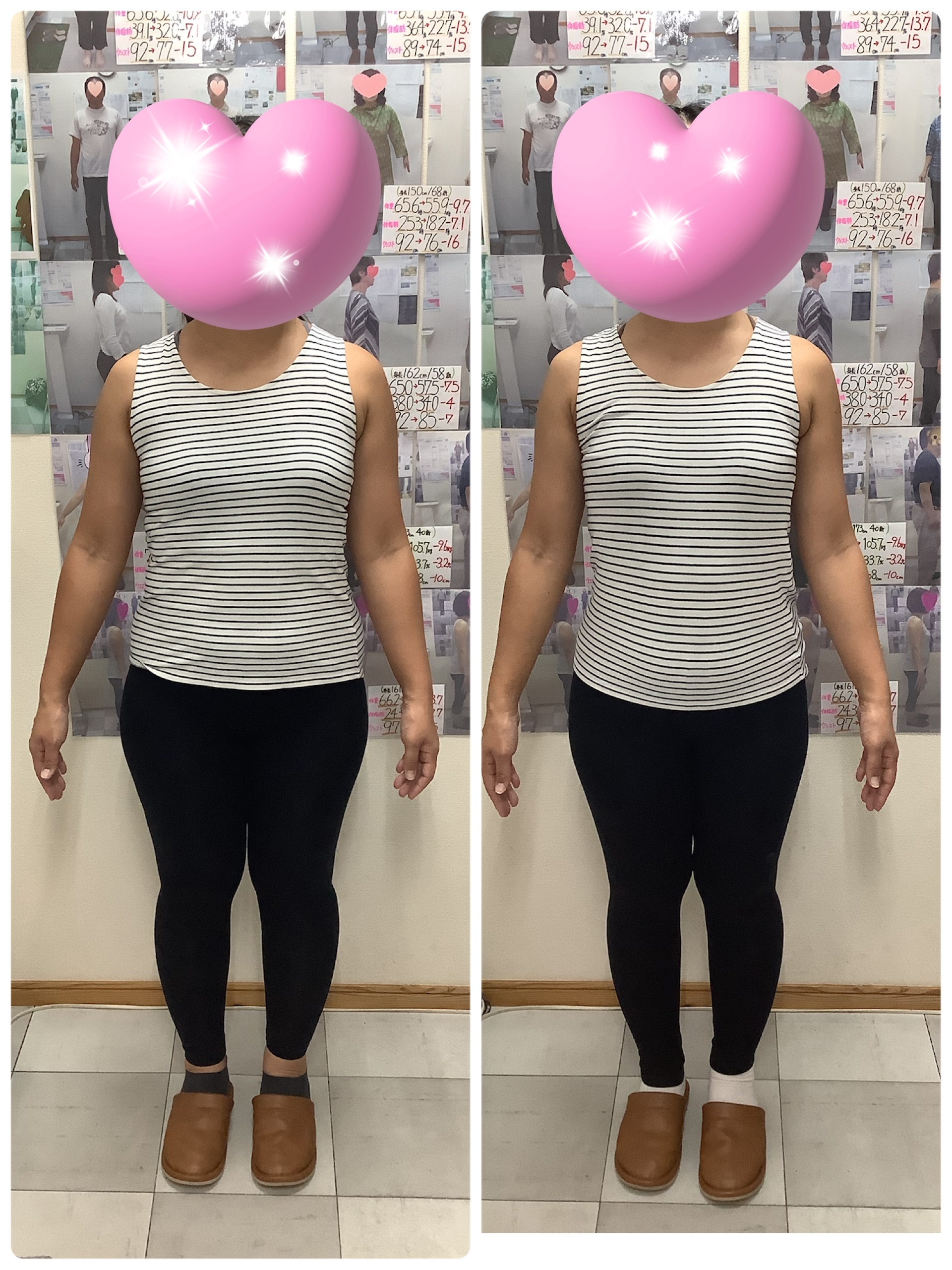 耳ツボダイエット　ビフォーアフターの写真