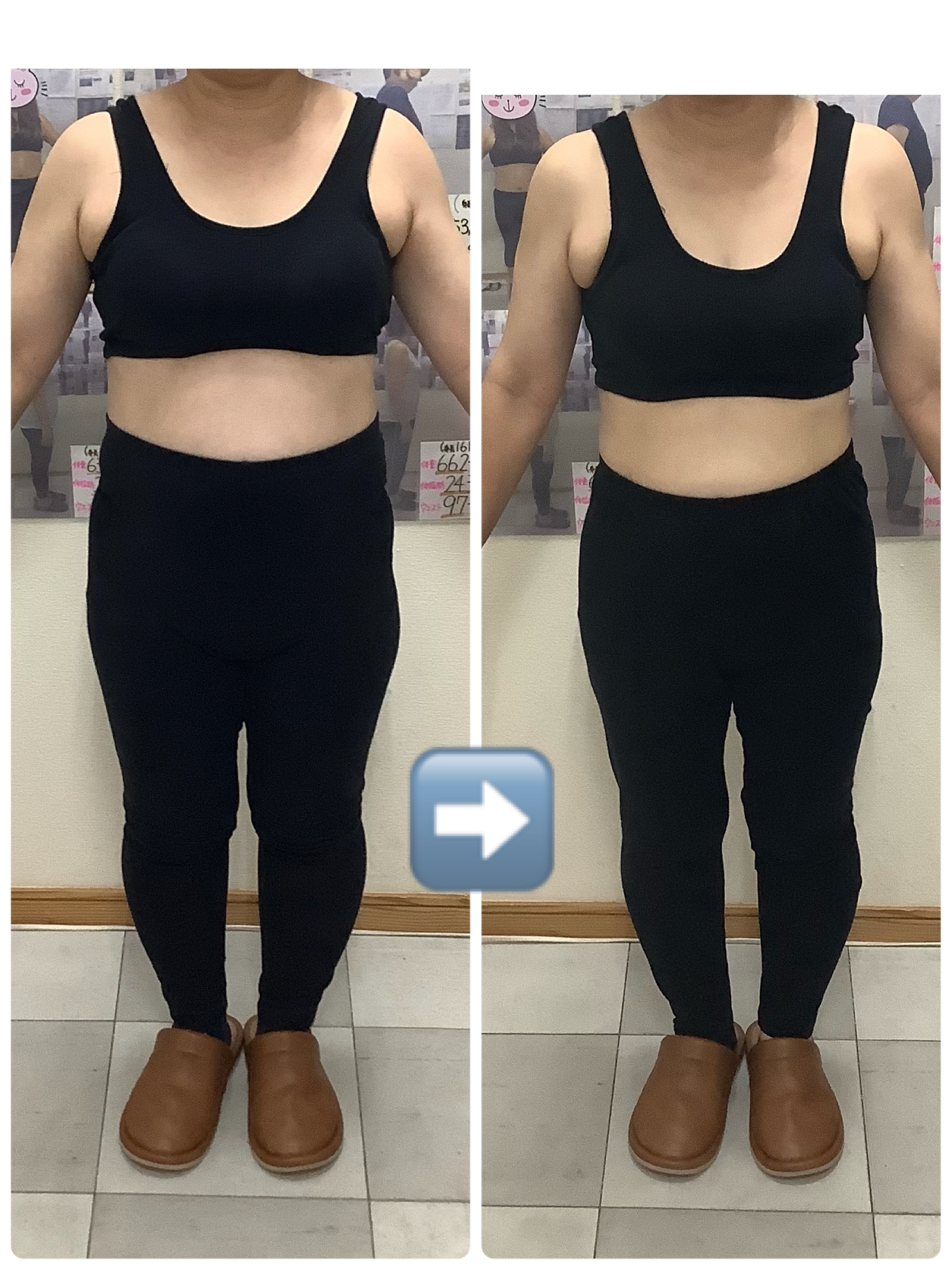 耳ツボダイエット ビフォーアフターの写真