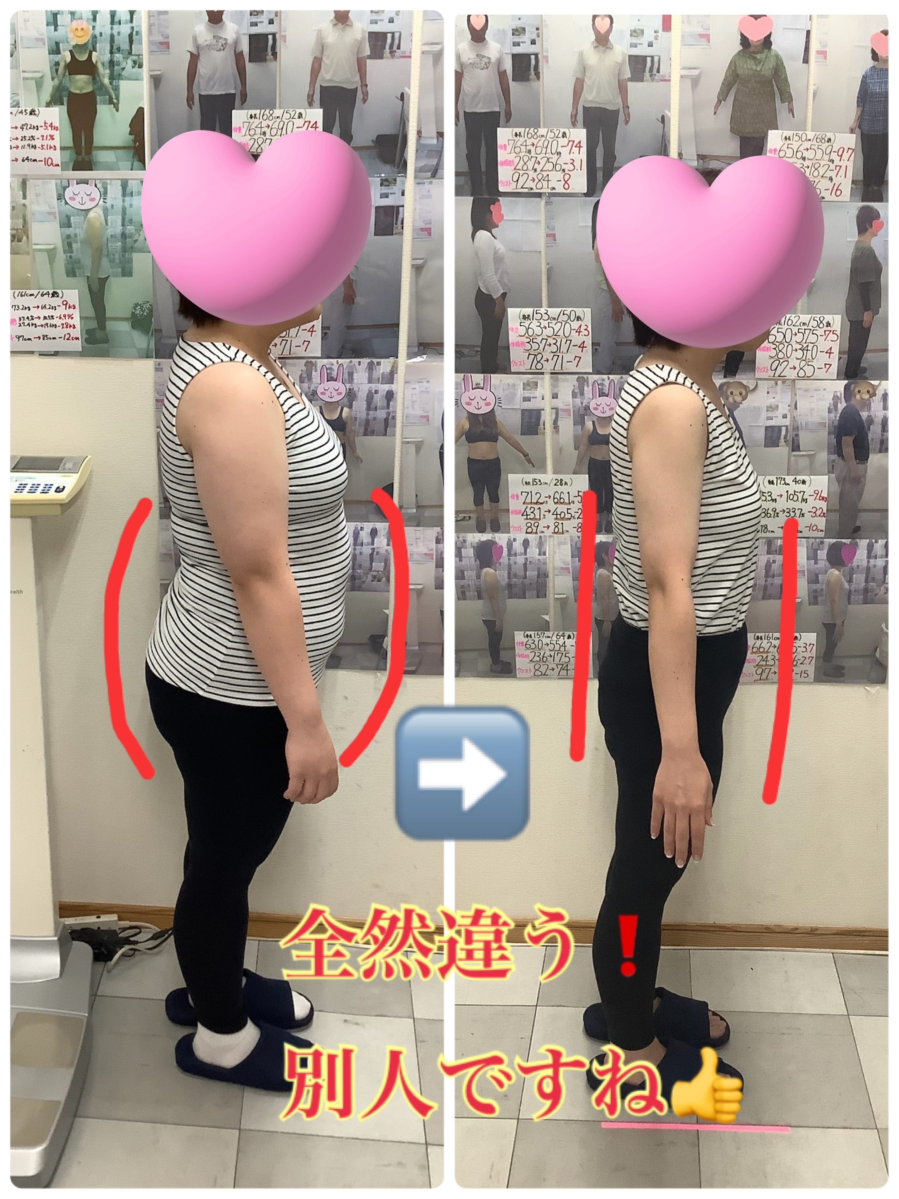 耳ツボダイエット　ビフォーアフターの写真