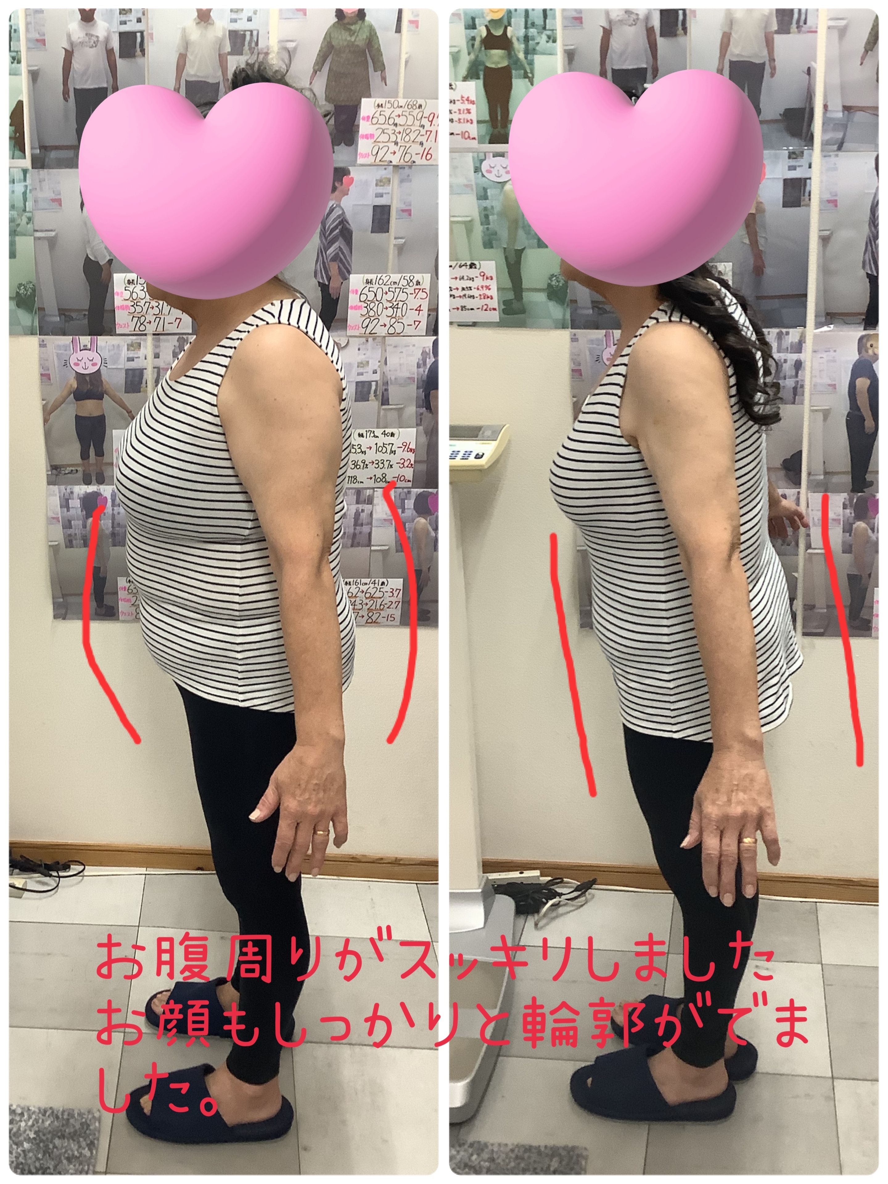 ゆらり整体・耳ツボダイエット　ビフォーアフターの写真です。