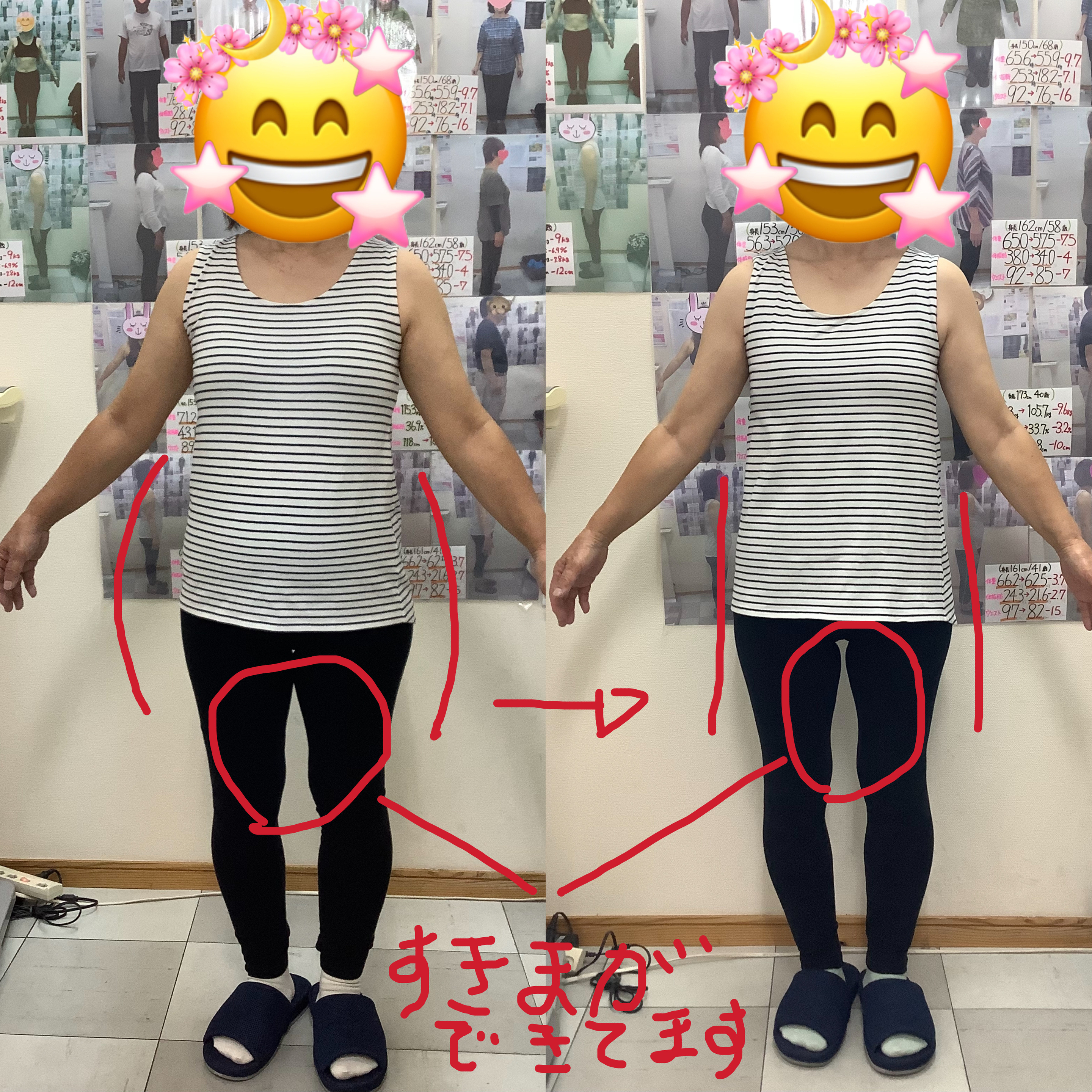 ヘルシー耳ツボダイエット　卒業生のビフォーアフター写真