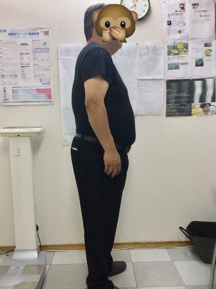 耳つぼダイエット前