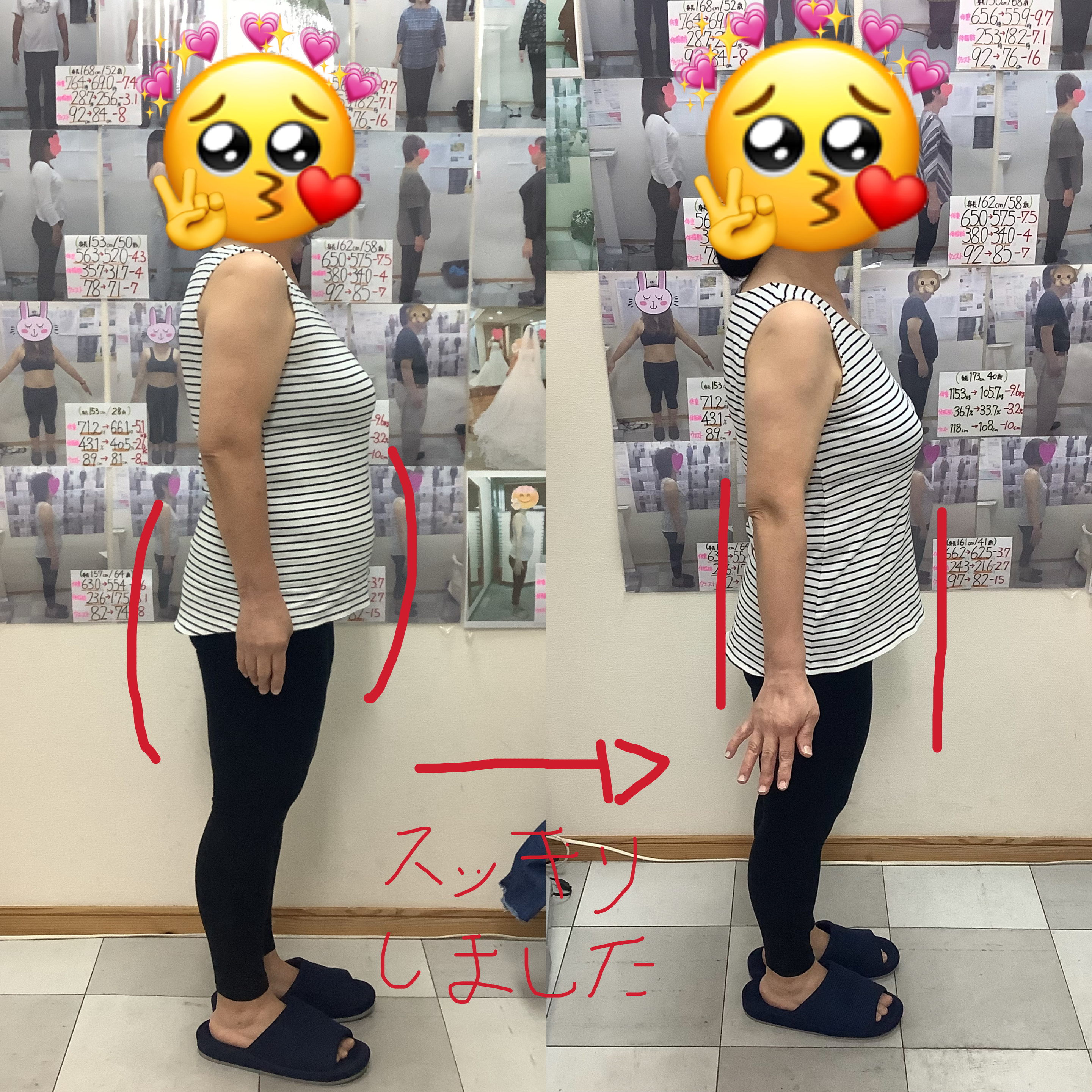 耳ツボダイエット　ビフォーアフターの写真