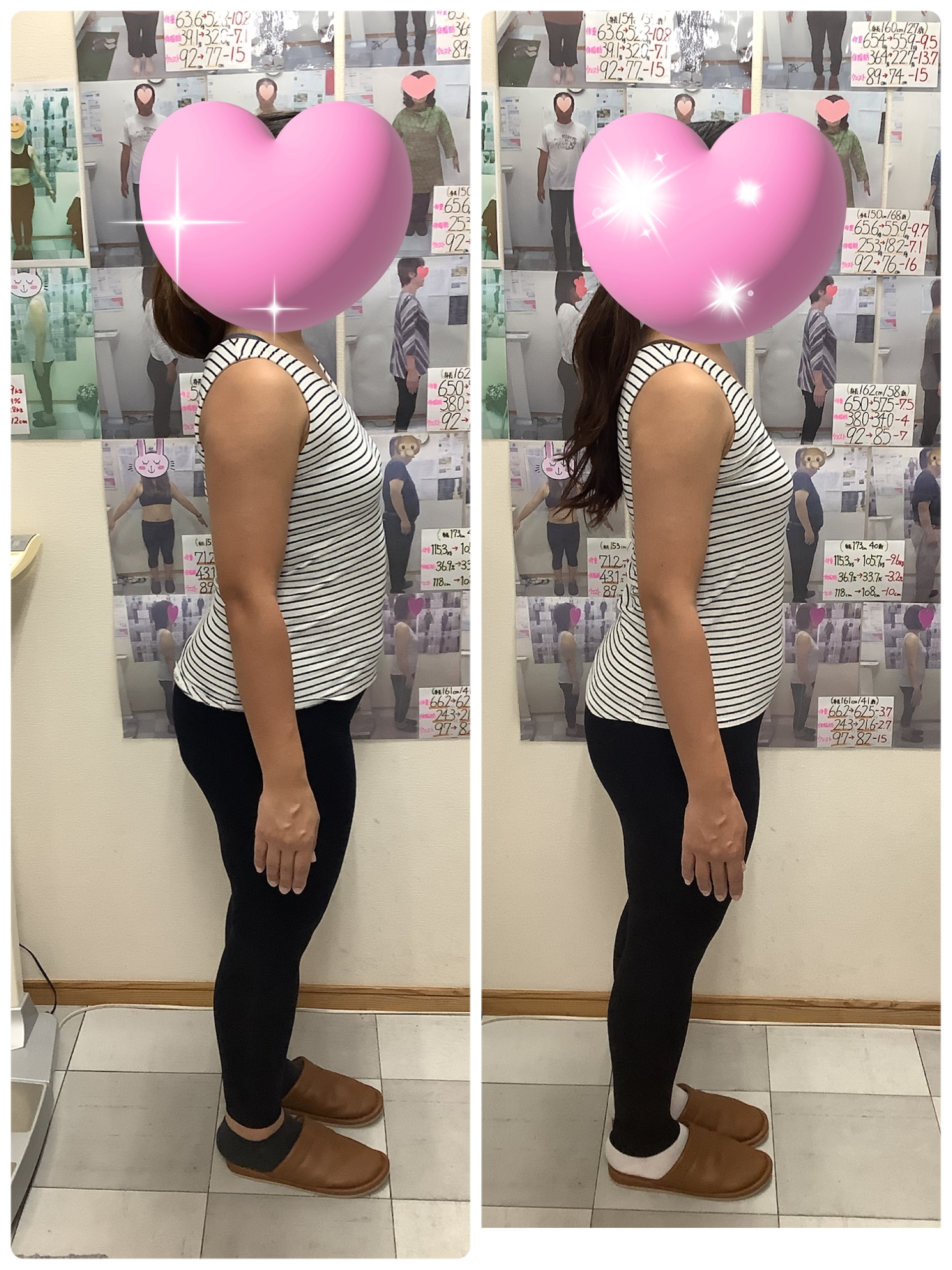 耳ツボダイエット　ビフォーアフターの写真