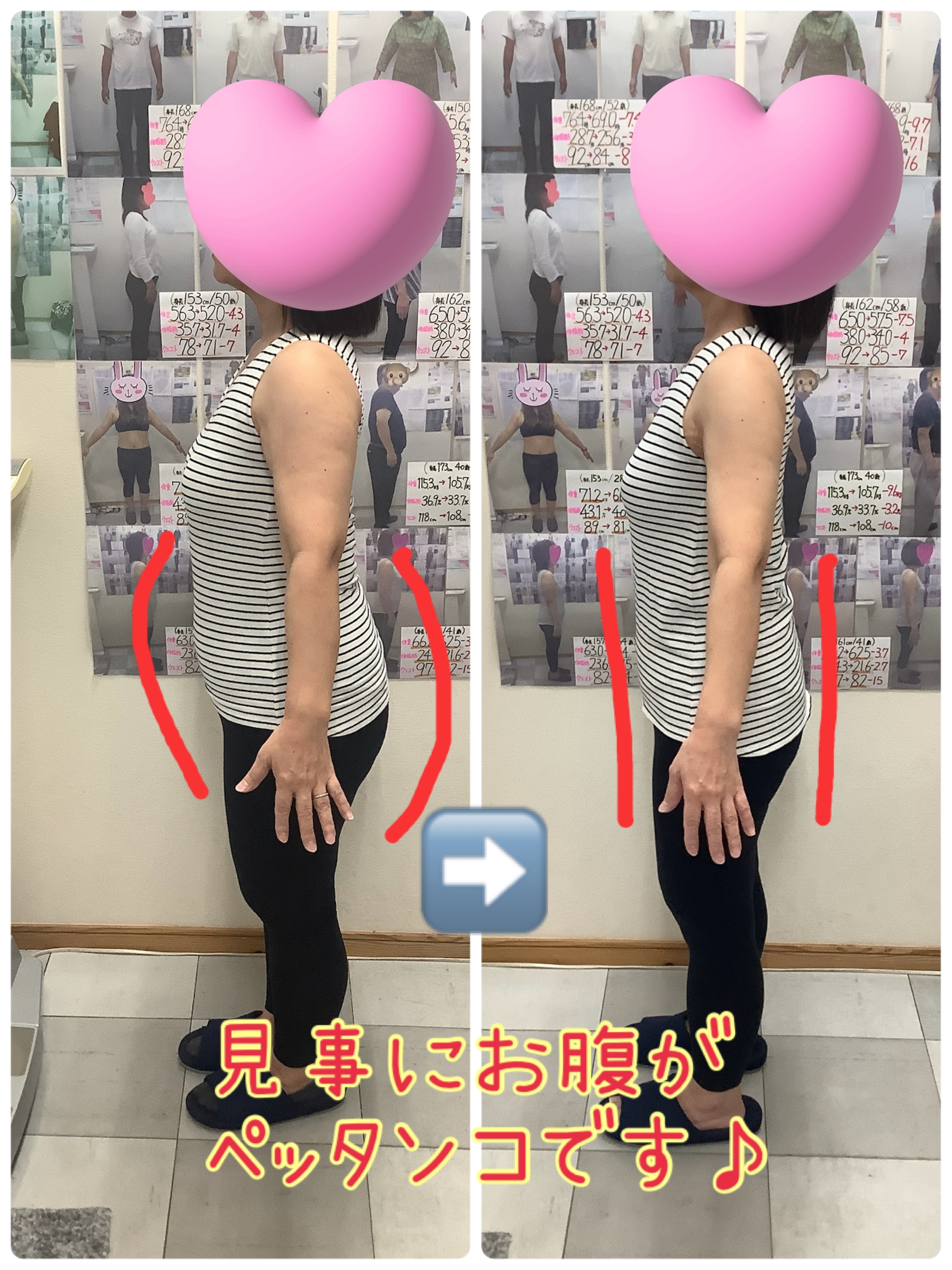 ゆらり整体・耳ツボダイエット　ビフォーアフターの写真