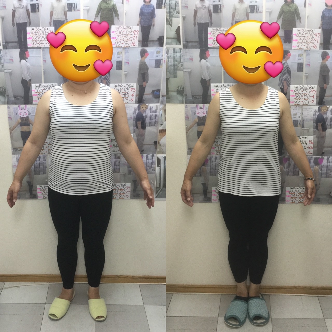 耳ツボダイエット　ビフォーアフターの写真