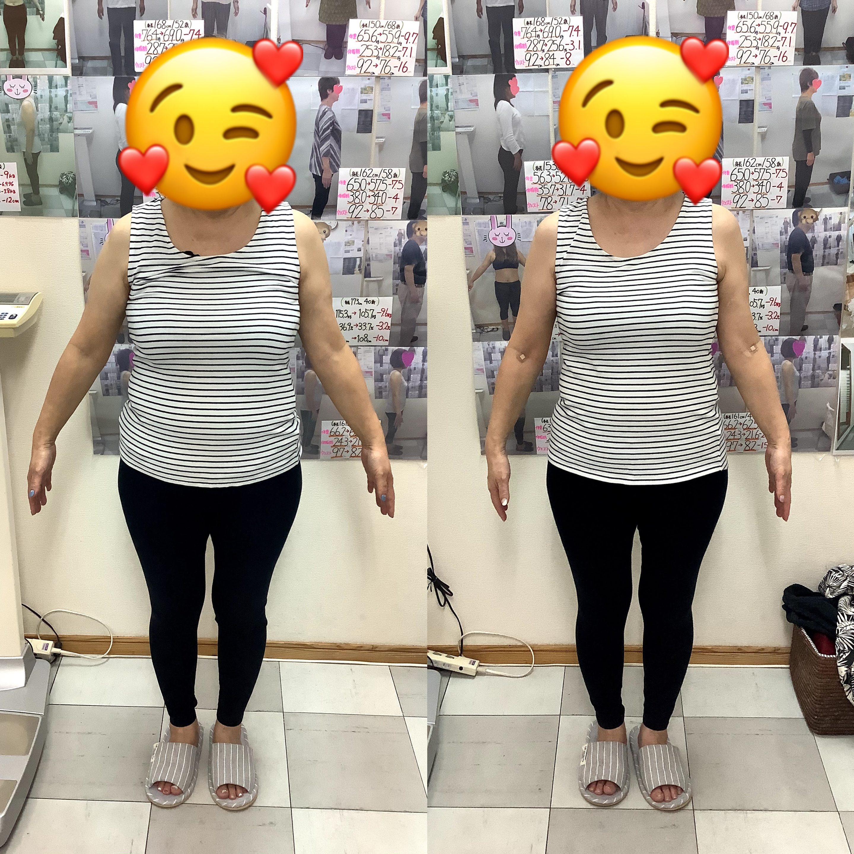 ゆらり整体耳ツボダイエット3ヶ月のビフォーアフターの写真