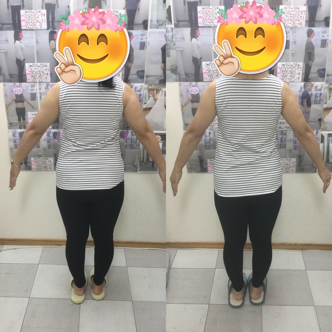 耳ツボダイエット　ビフォーアフターの写真