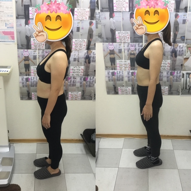 耳ツボダイエット　ビフォーアフター写真