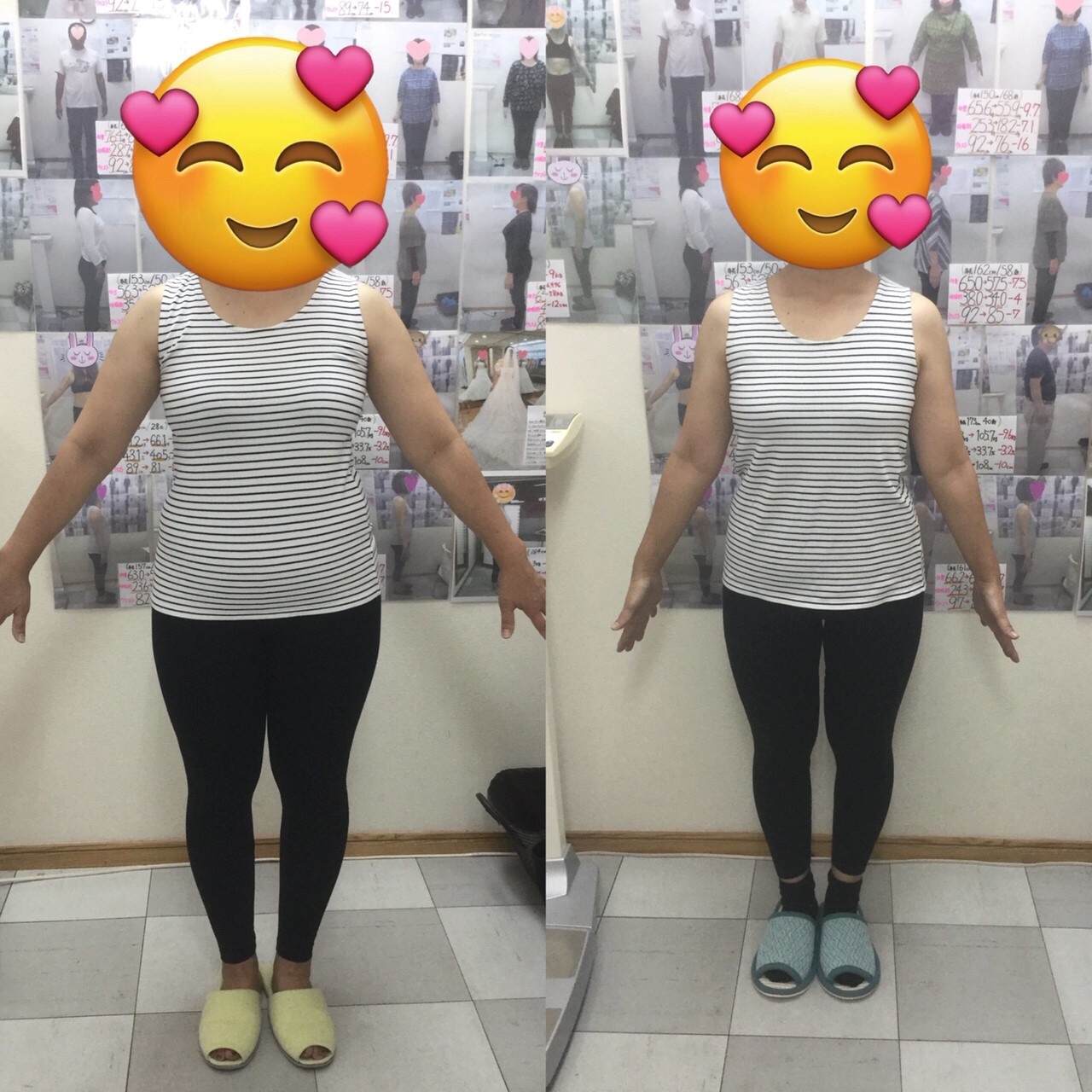 耳ツボダイエット　ビフォーアフターの写真